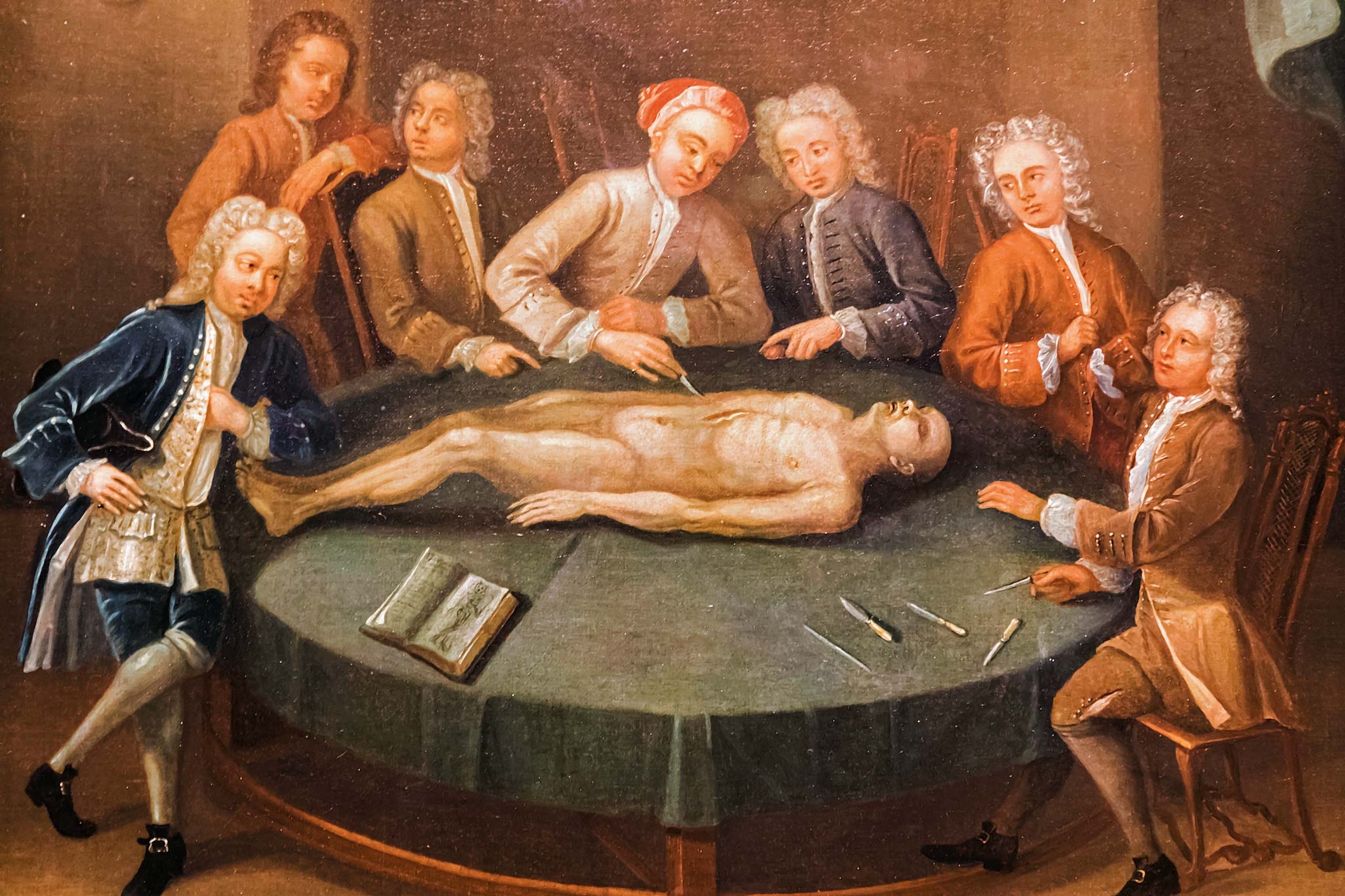 18th-century painting of an anatomy lesson using a cadaver