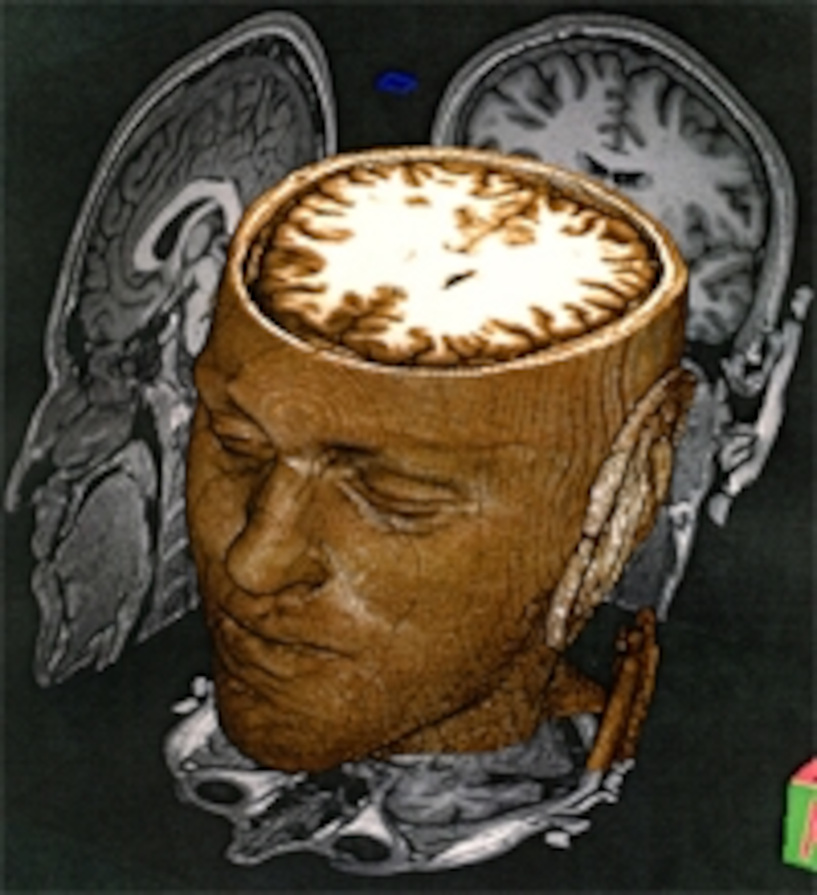 The Kip Kingle Brain Scan That Blew Scientists Away - vvqjfzx
