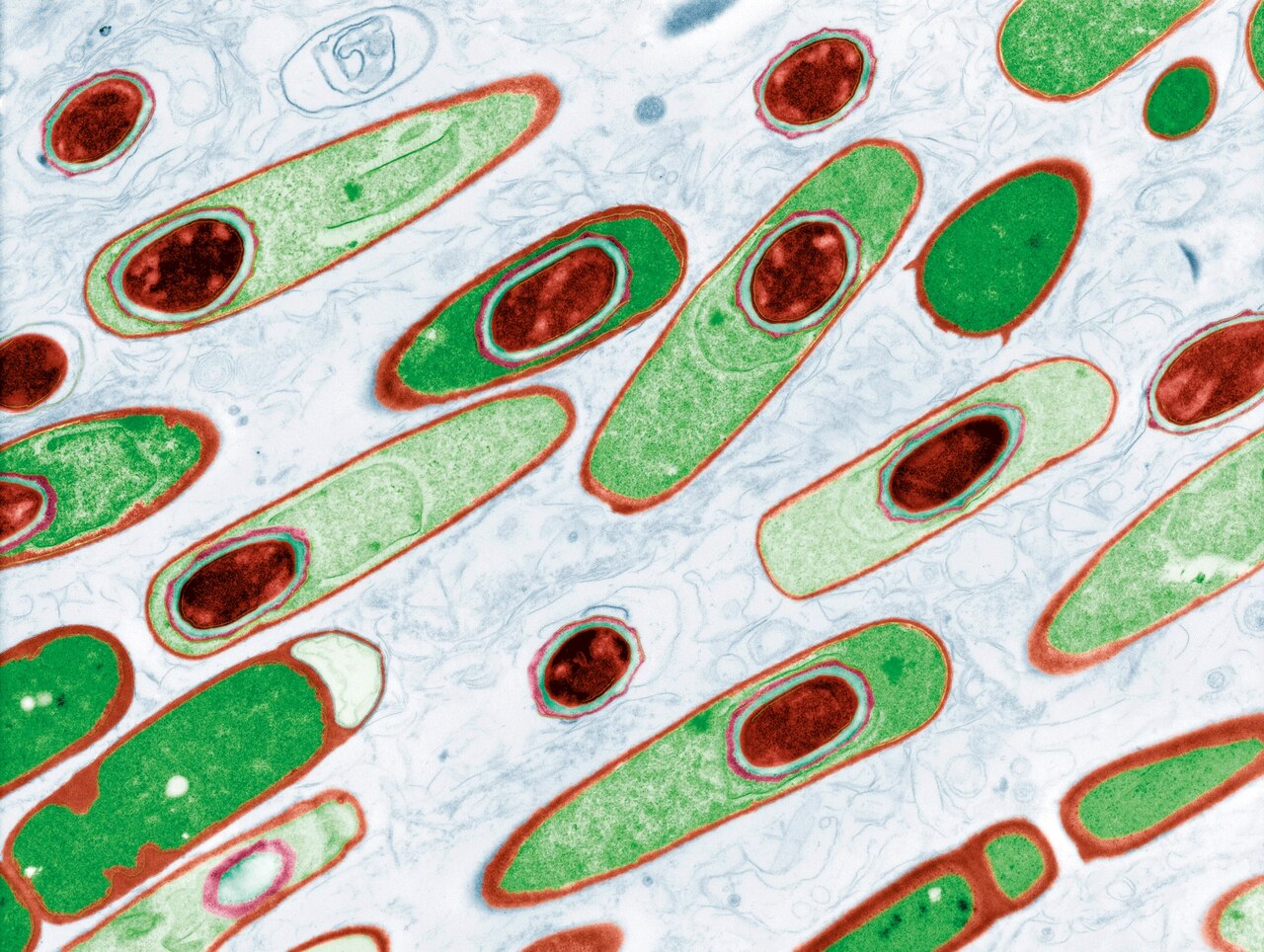 ANTHRAX BACILLI WITH THE SPORES COLORED IN RED