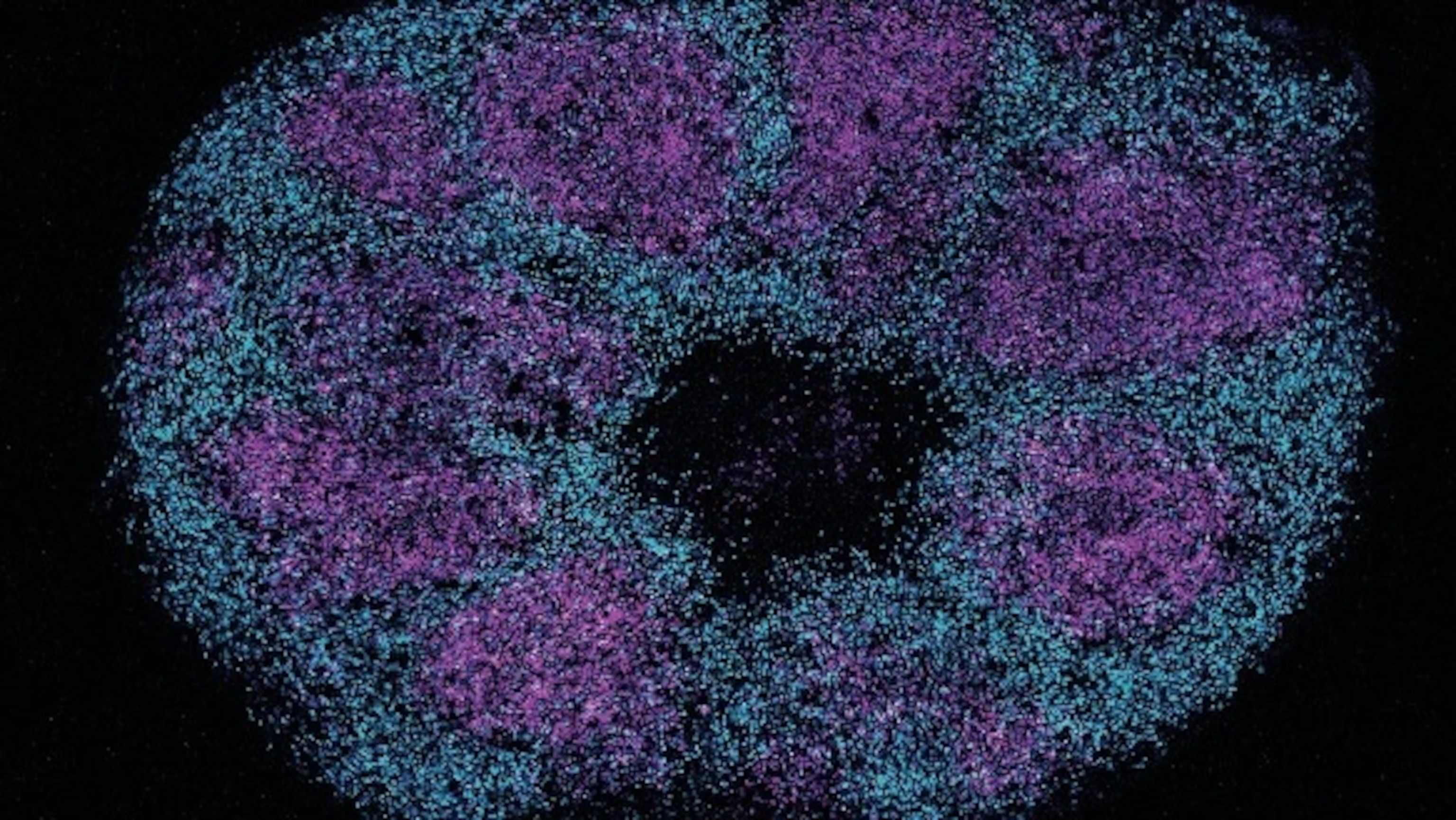 Scientists Create Most Detailed Map Yet of Proteins Linked to Autism
