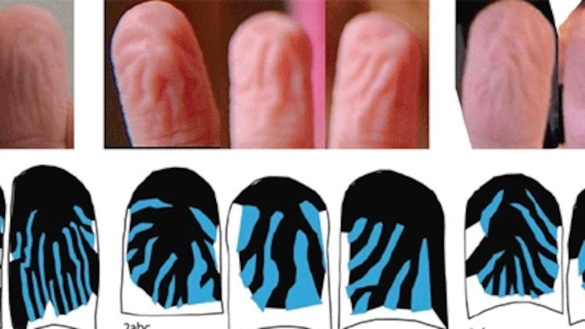 What is the point of pruney fingers?