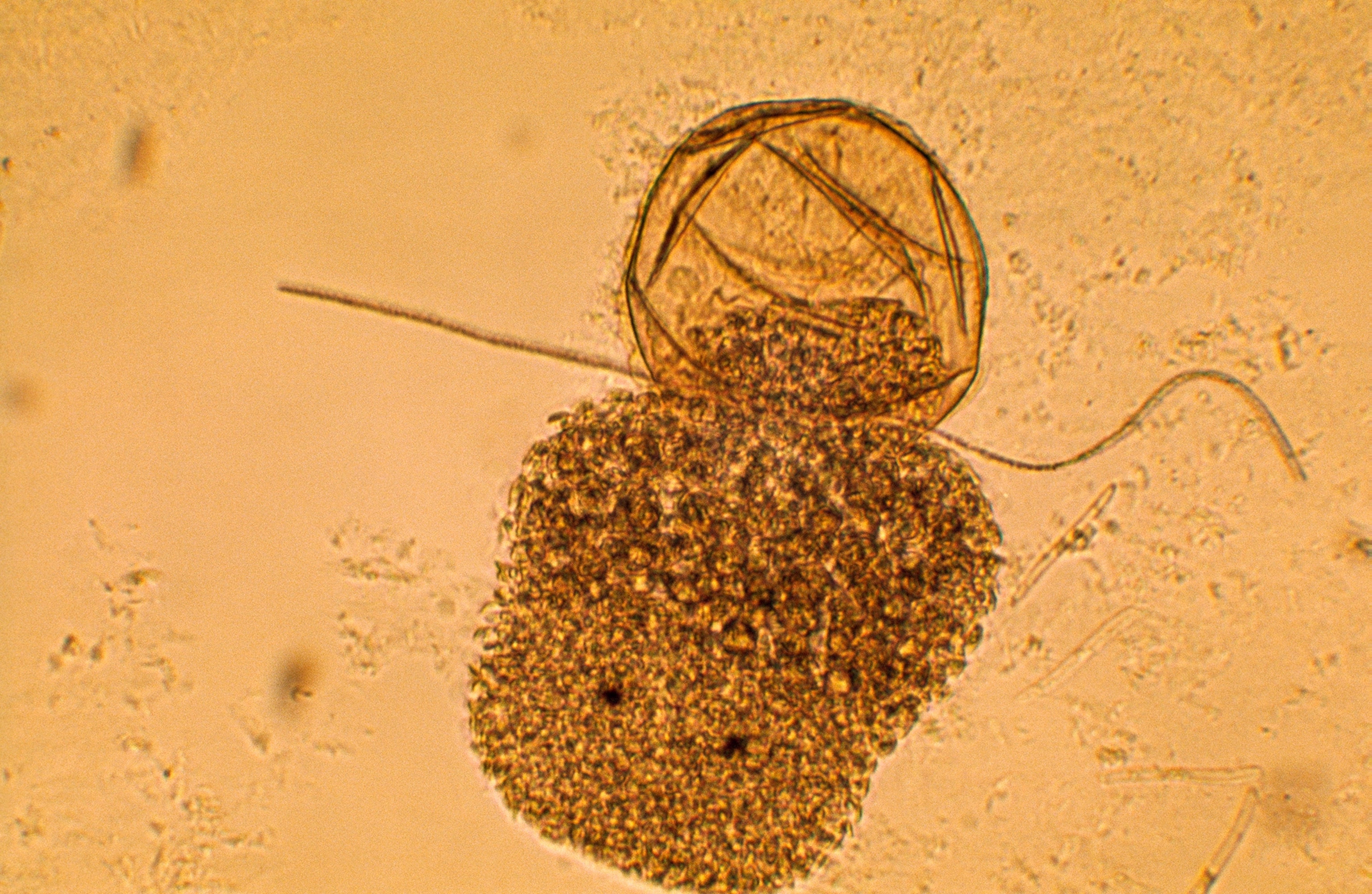 Climbing out of its egg sac, a baby turbellarian, or flatworm, looks for its first meal. It is one of the first carnivores in the mangrove food chain. Often less than 1/25th of an inch long when full grown, these voracious creatures inhabit the film of fungi and bacteria that forms on dead mangrove leaves during organic breakdown. Comprised almost entirely of digestive sac, flatworms swallow animals up to half their own size, such as nematodes and copepods. Their two eyespots probably can detect light.