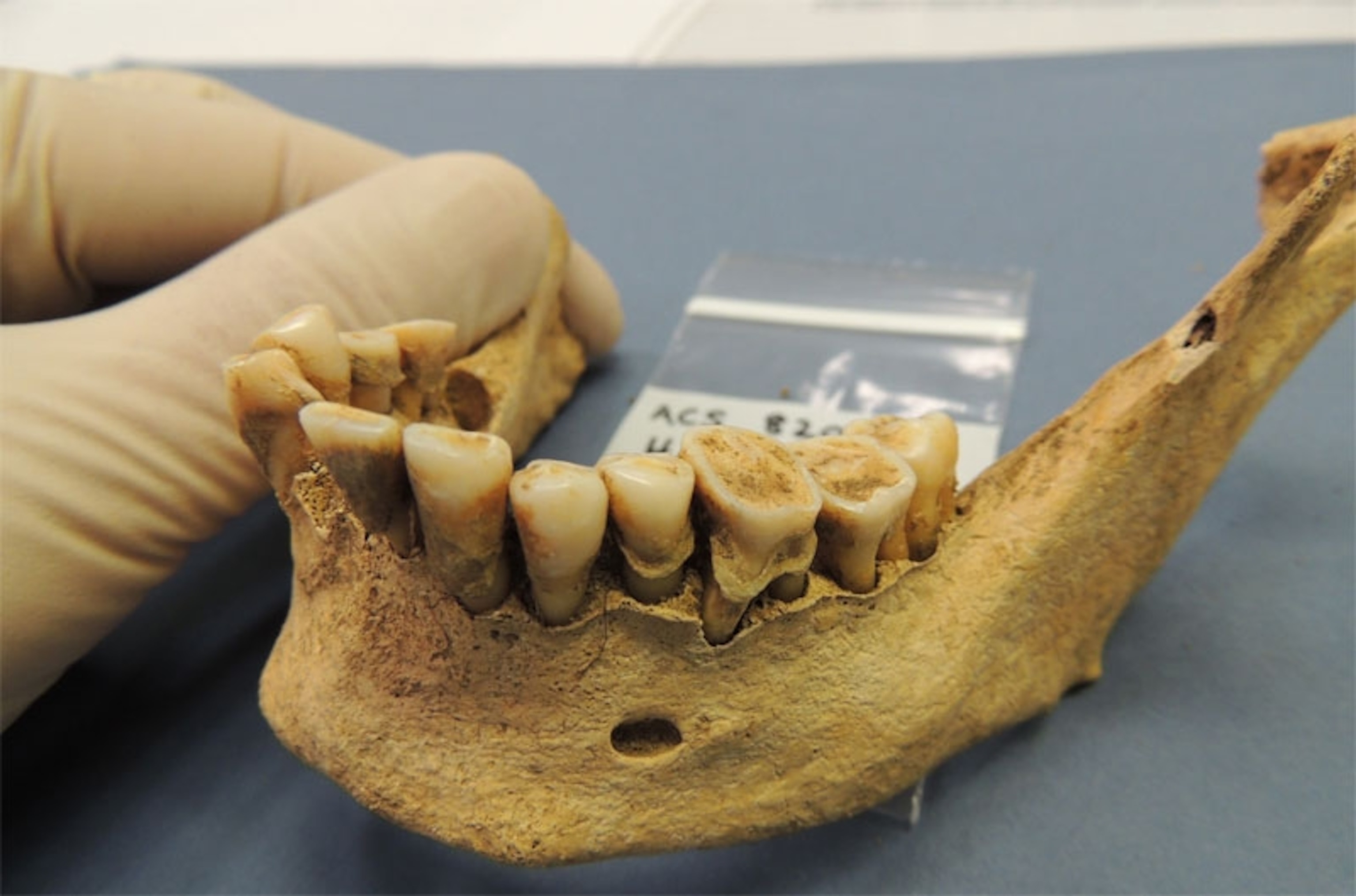 Jaw from one of the first farmers in Germany. Credit: Alan Cooper