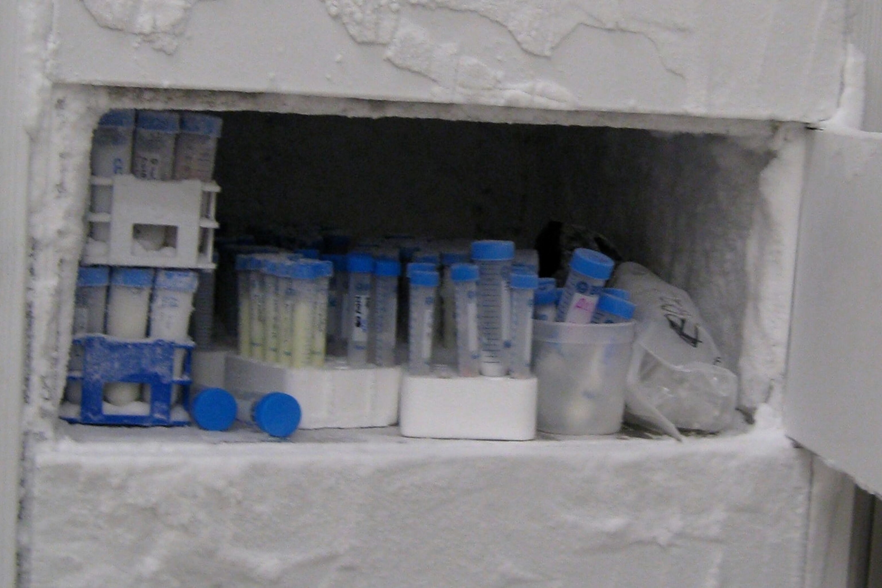A Dead Disease Still Lives in Lab Freezers. What Else Does?