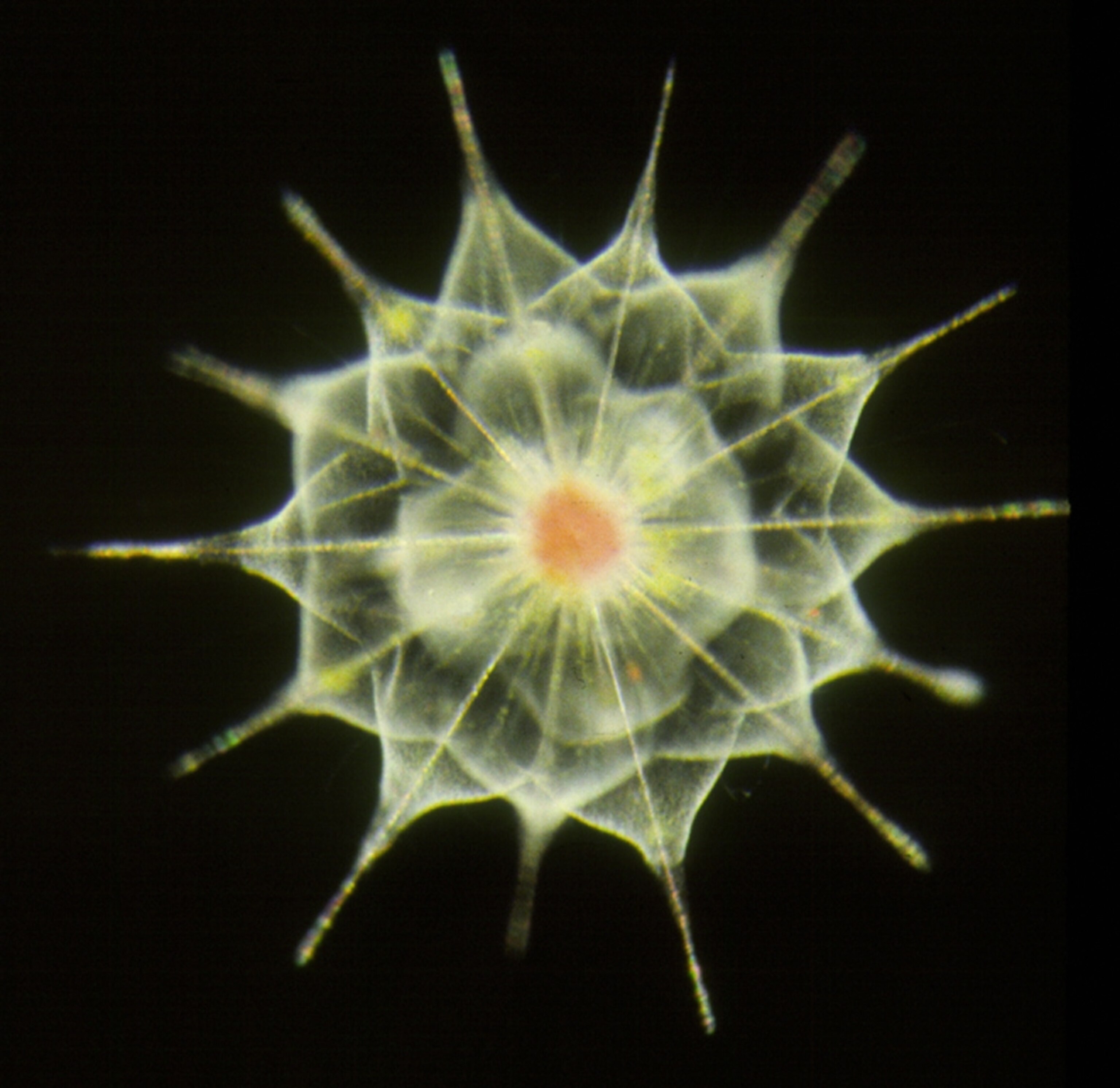 An acantharian amoebae encased in a protective shell, inventoried as part the Census of Marine Life's study of hard-to-see sea creatures