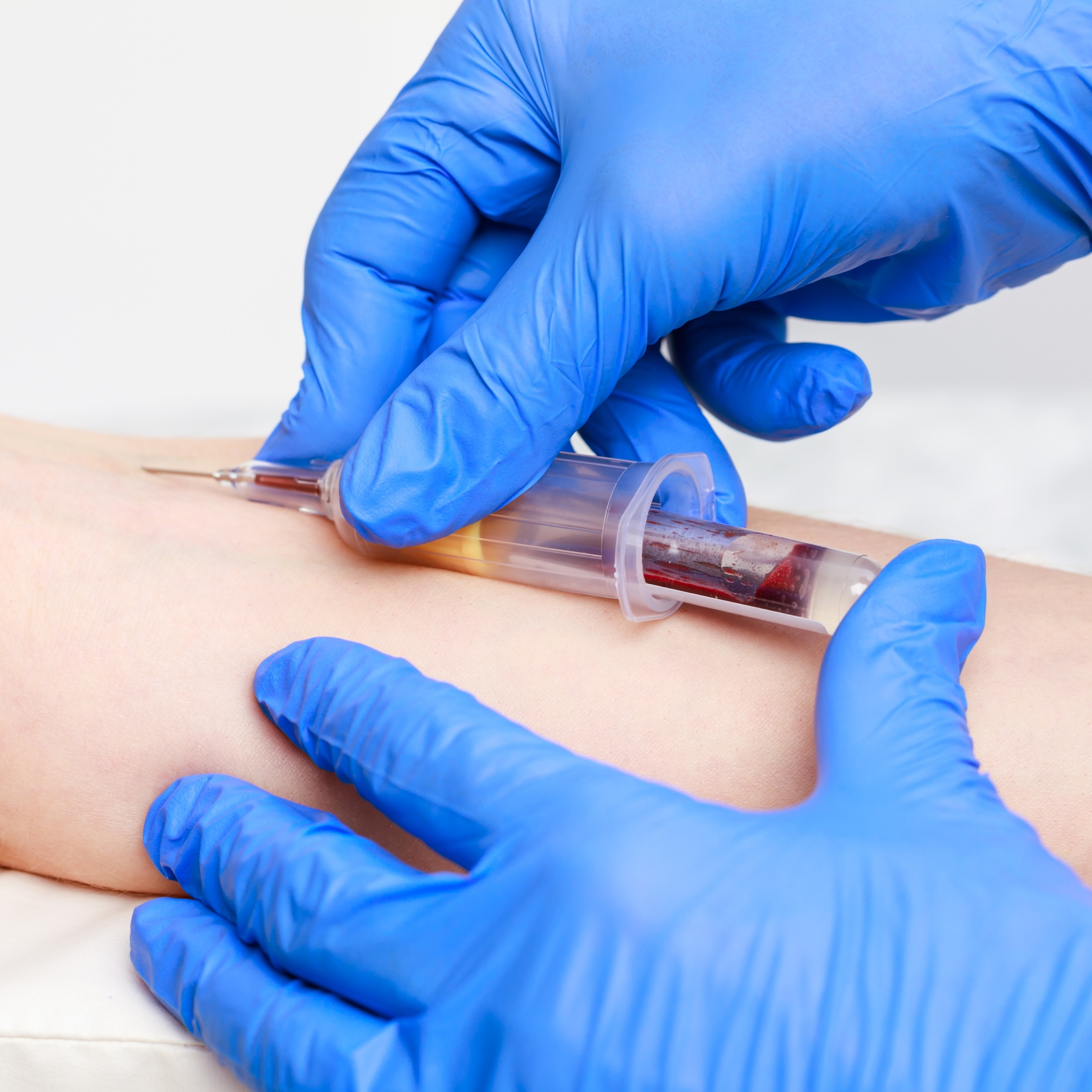 A close-up view of gloved hands drawing blood from a patient's arm