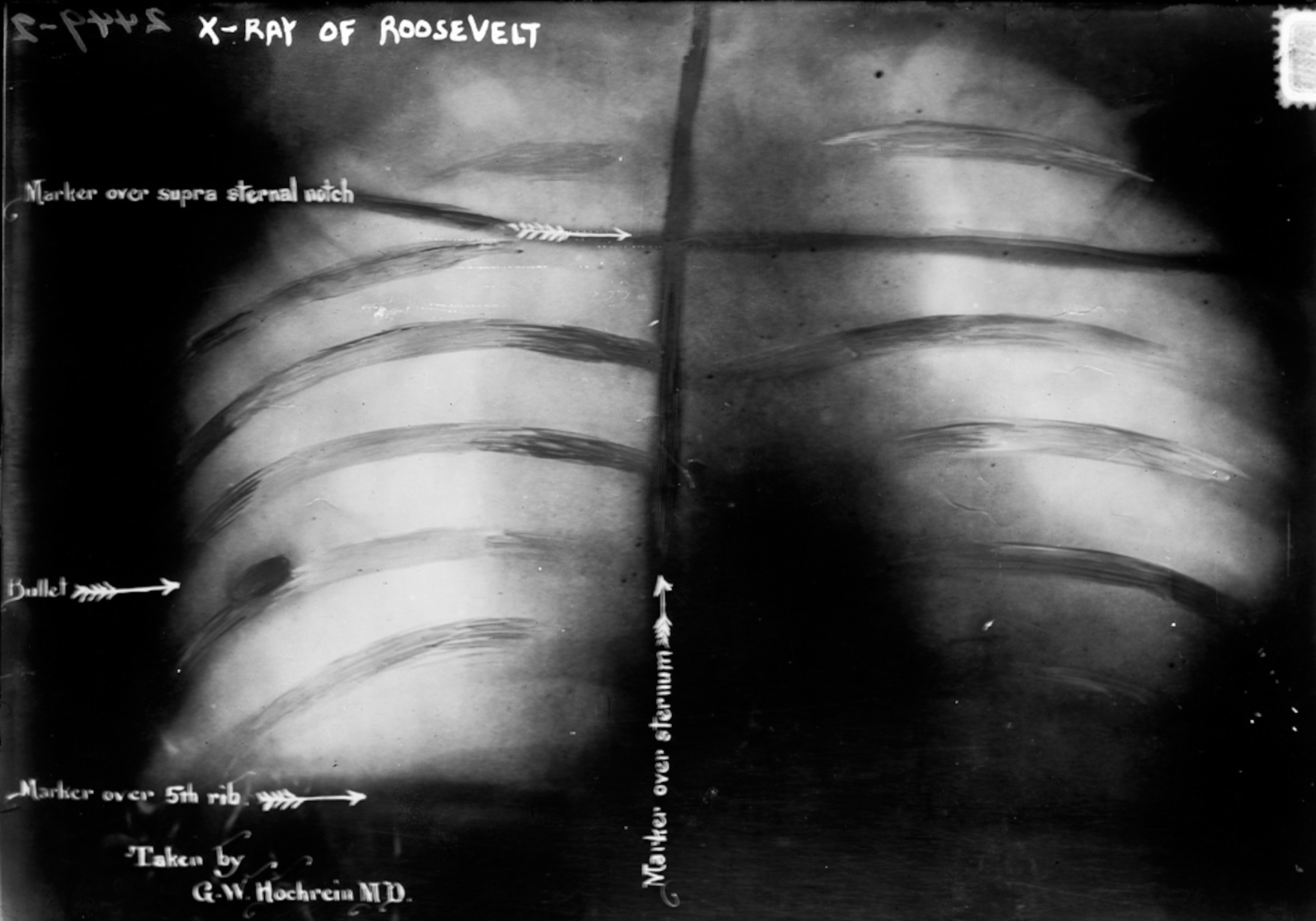 Photos: X-Ray History—Hidden Kittens, Quackery, and More