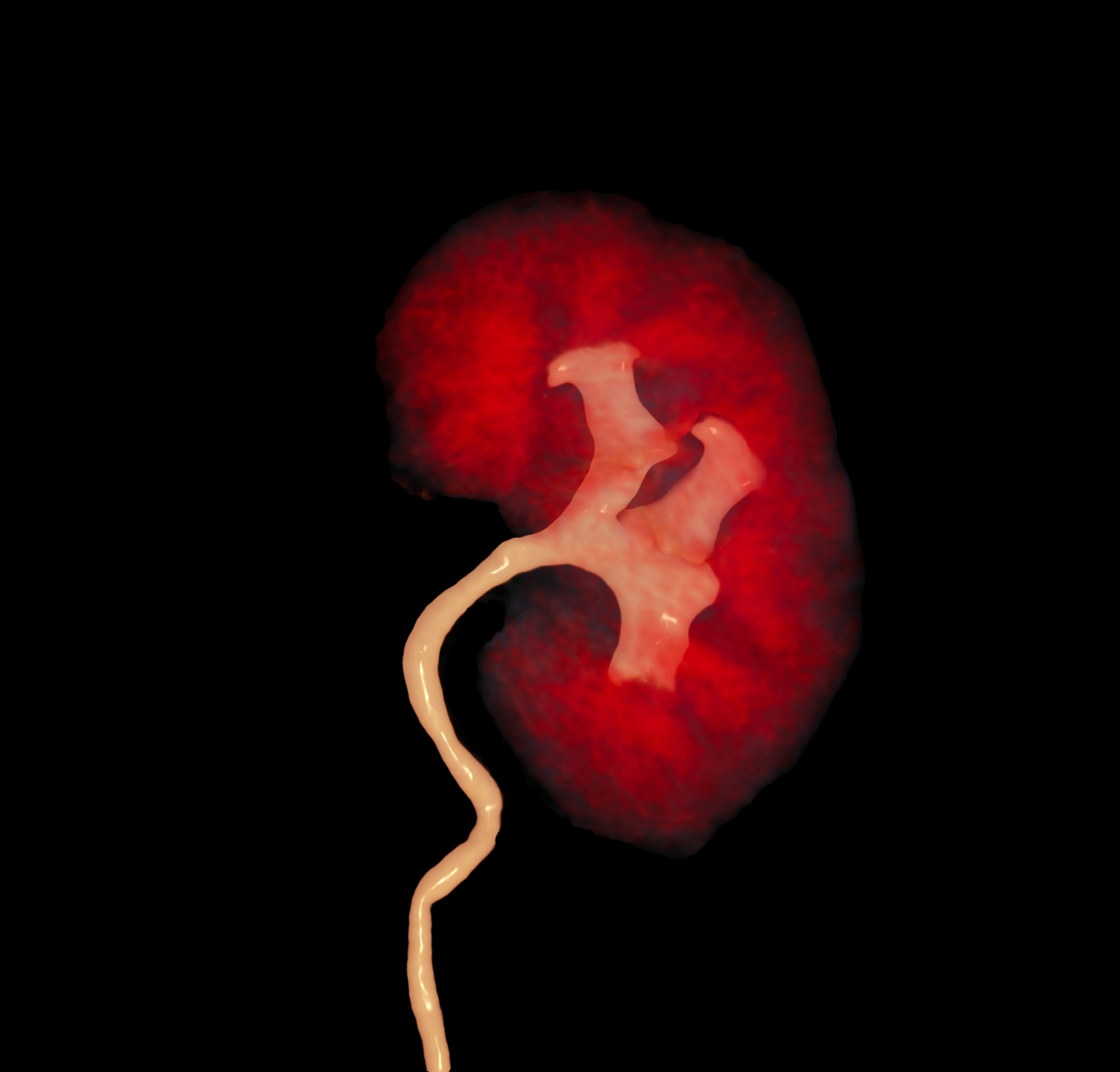 A colorized CT scan of a human kidney