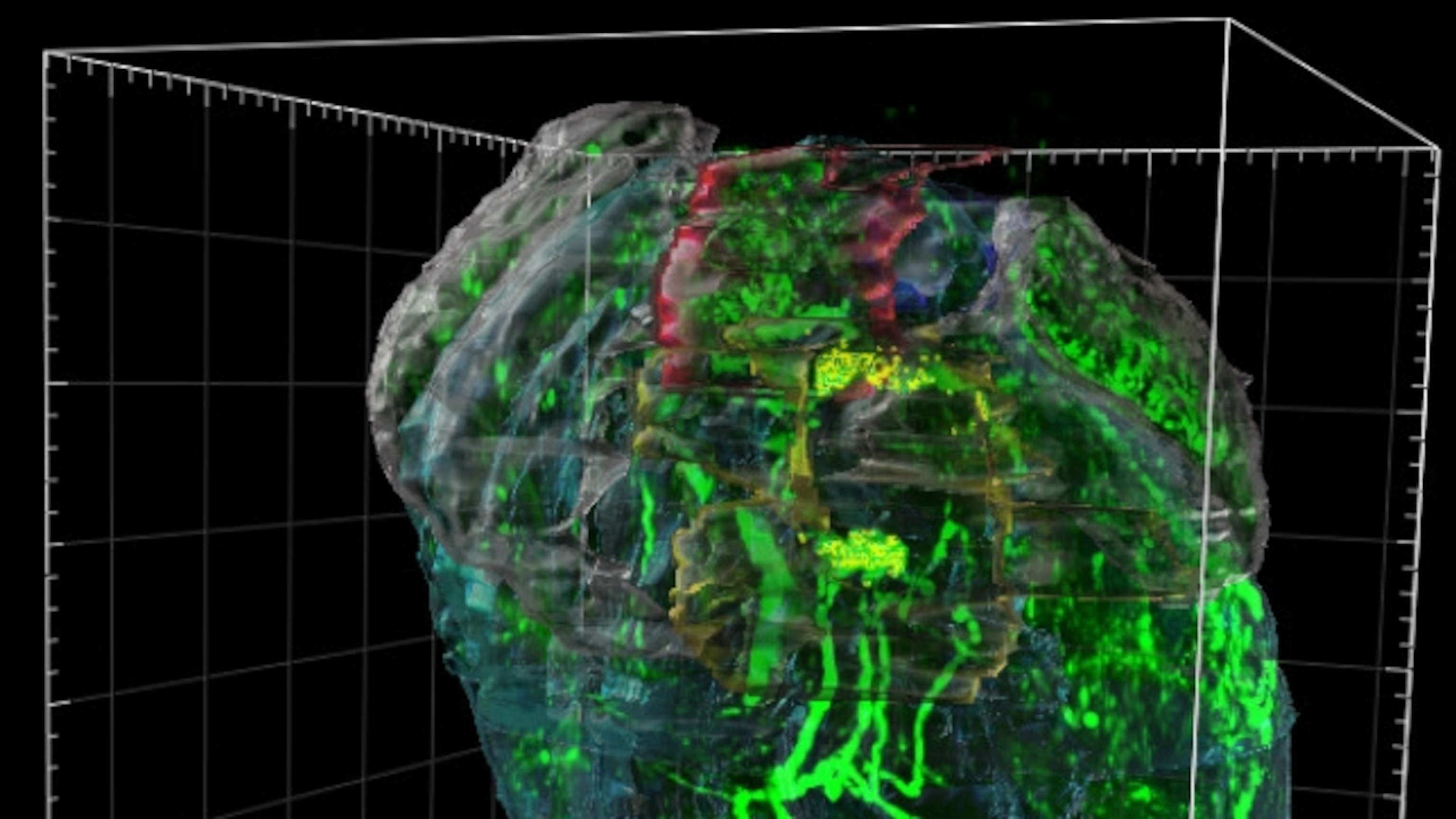 Unlocking the Mysteries of the ‘Mini Brain’ Inside Your Heart