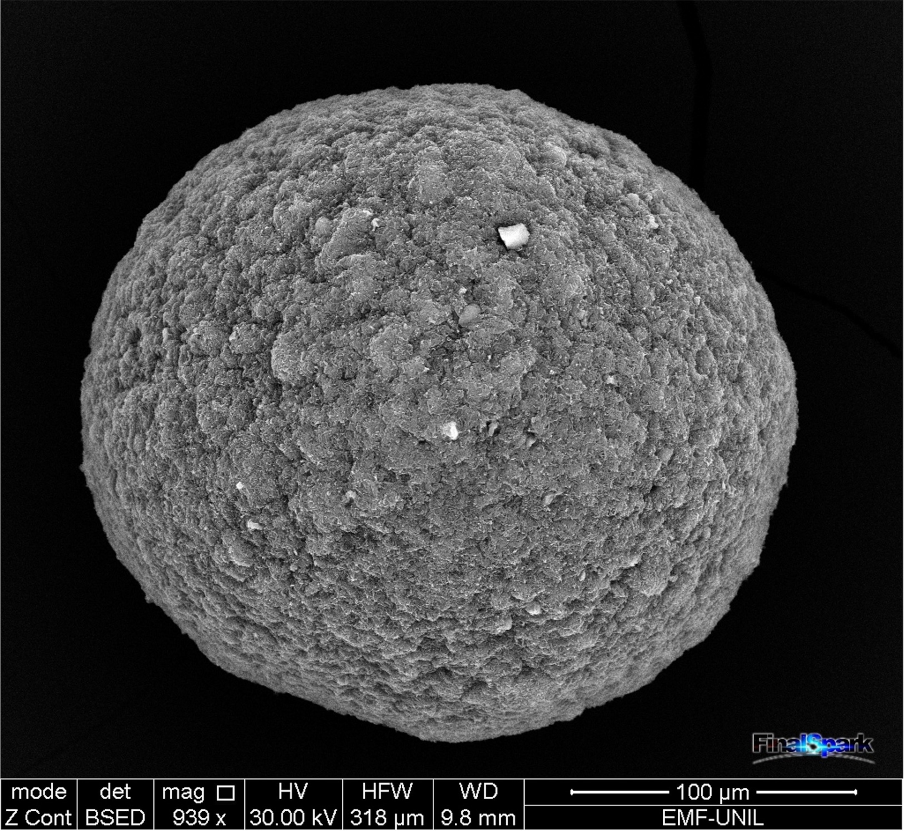 A microscopic view of a spherical clump of nerve cells