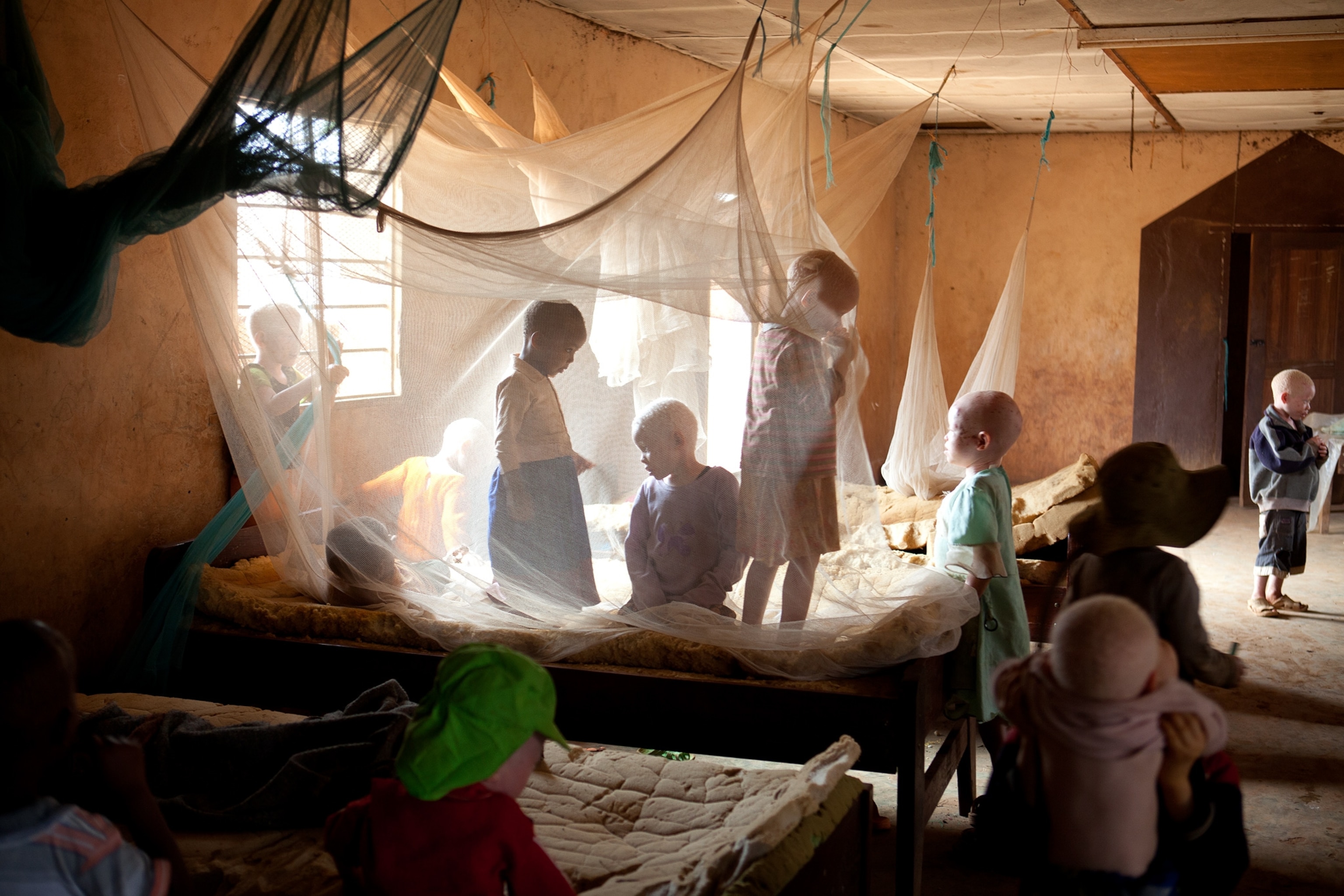 albino children playing with mosquito netting at the Kabanga Protectorate Center, Tanzania