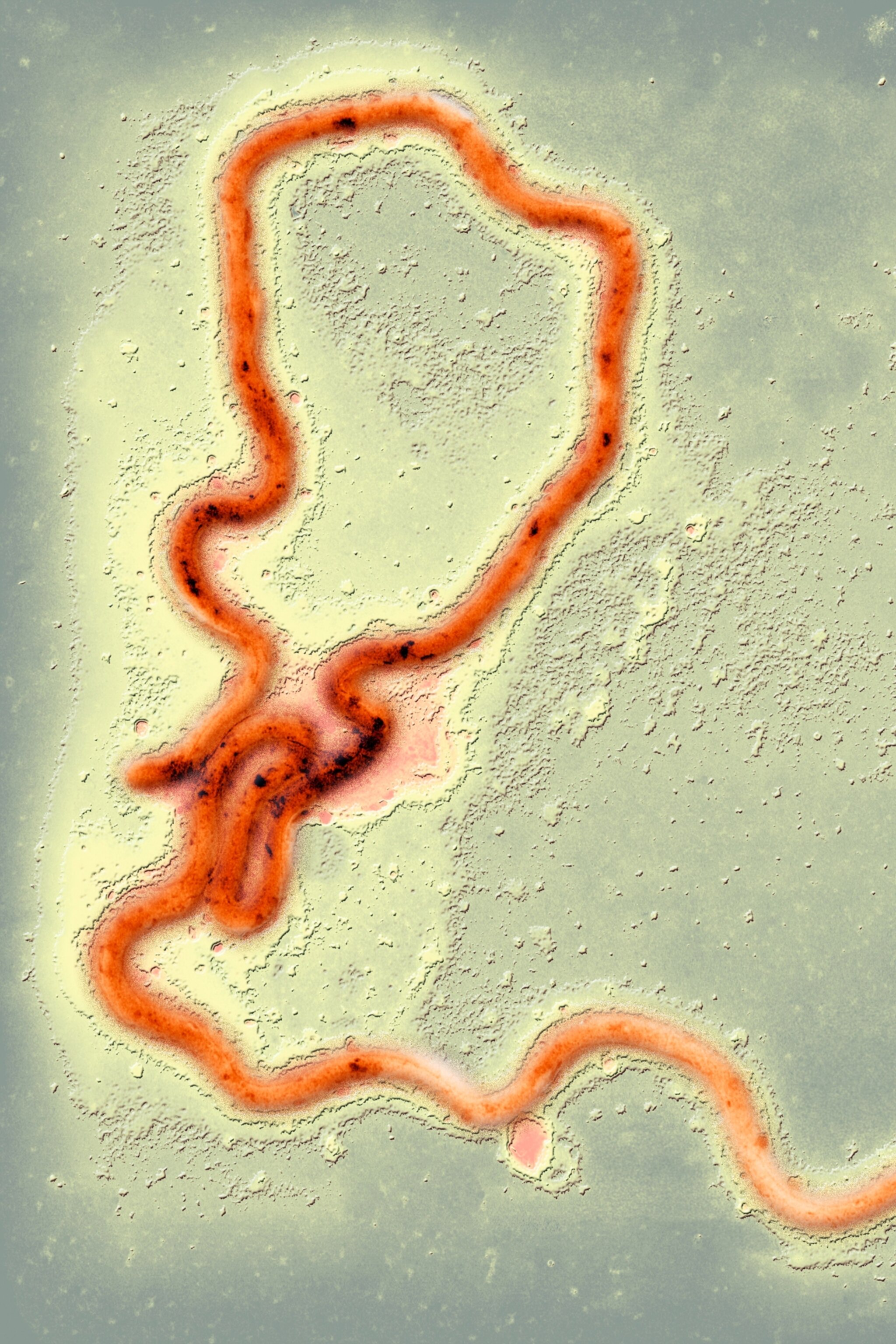 STDs are at a shocking high. How do we reverse the trend?