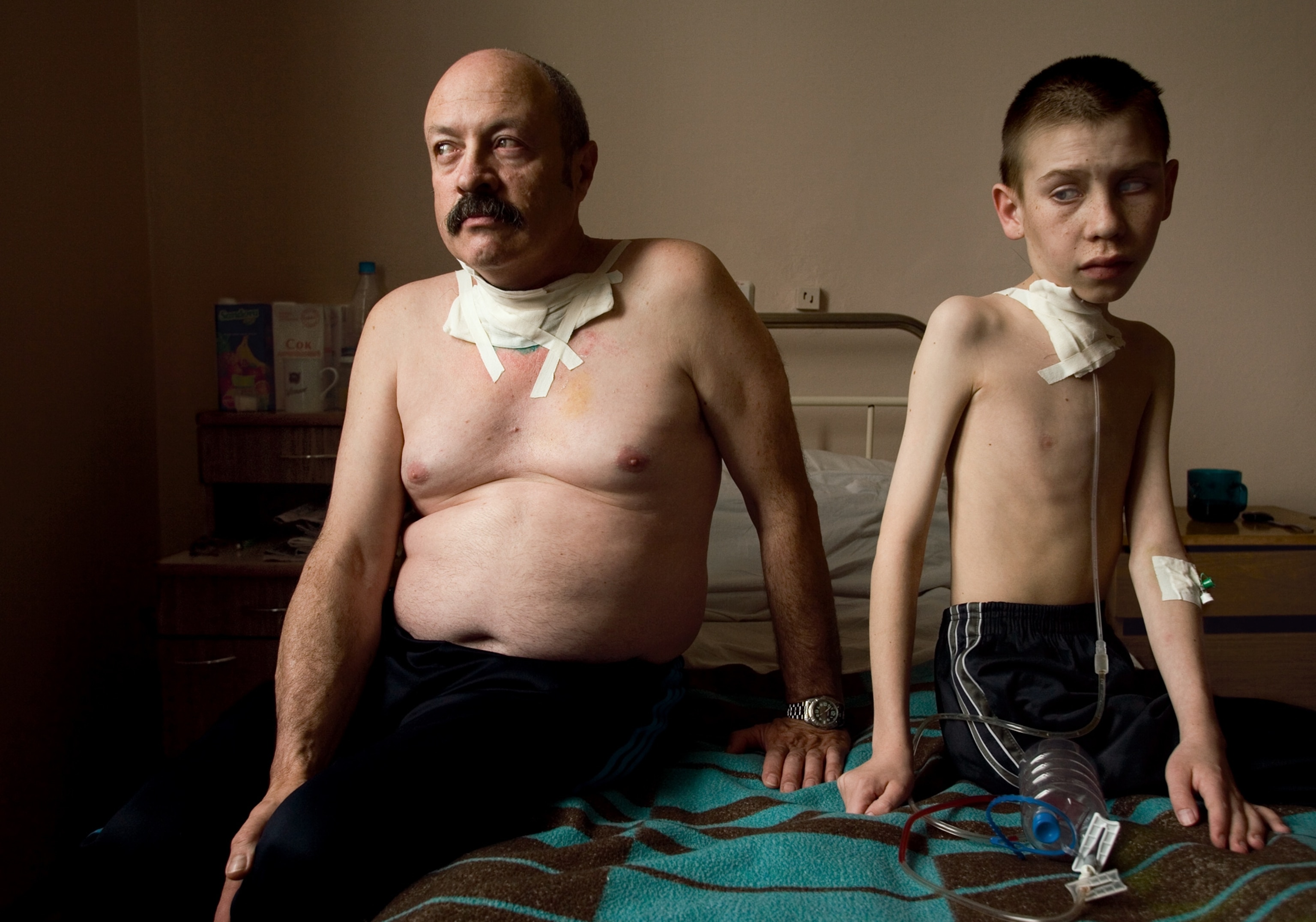 A man and a boy suffering from thyroid cancer at a thyroid center.