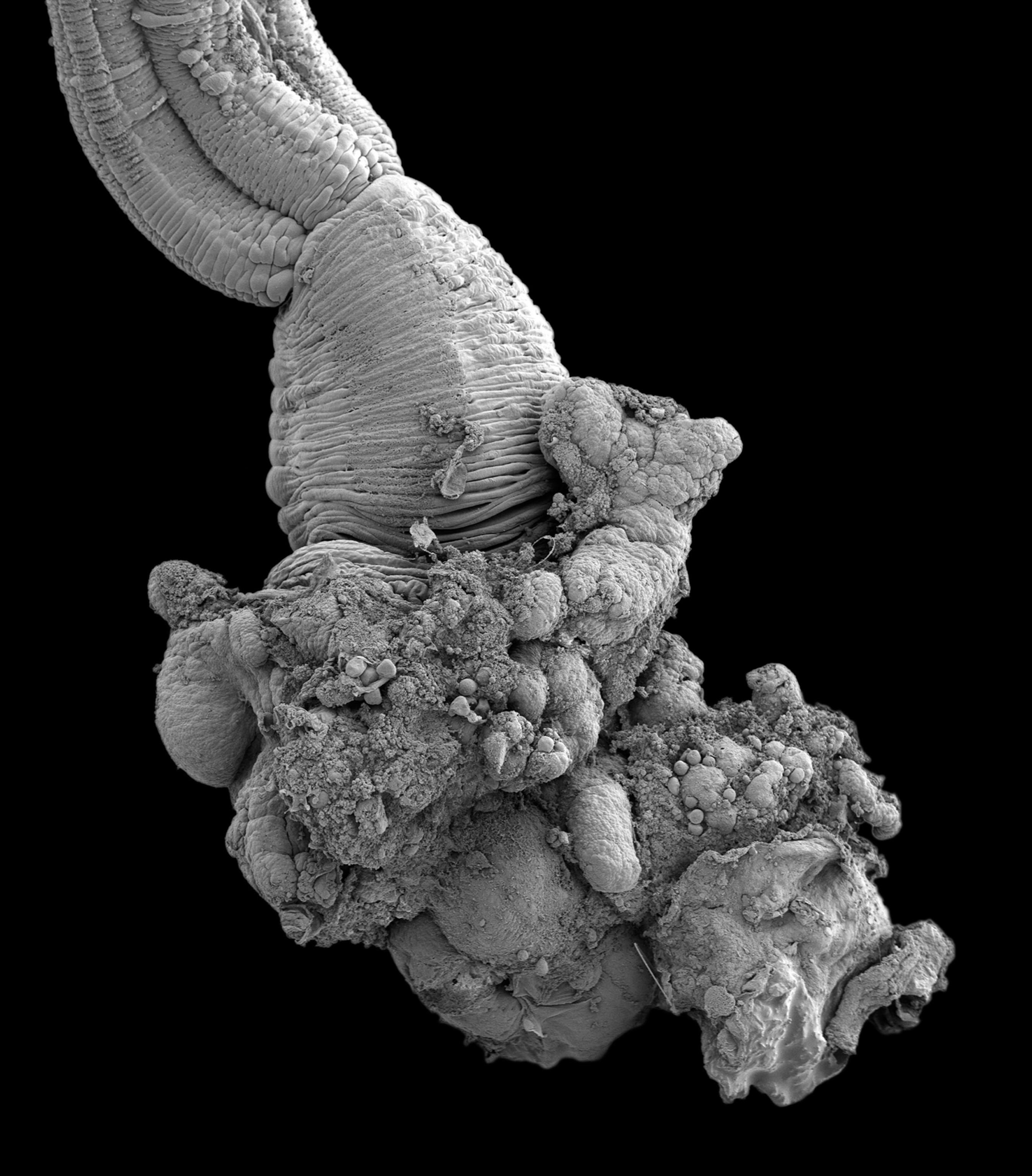 New Boneworm - High-resolution electron micrograph of a new species of bone-eating worm from Antarctica