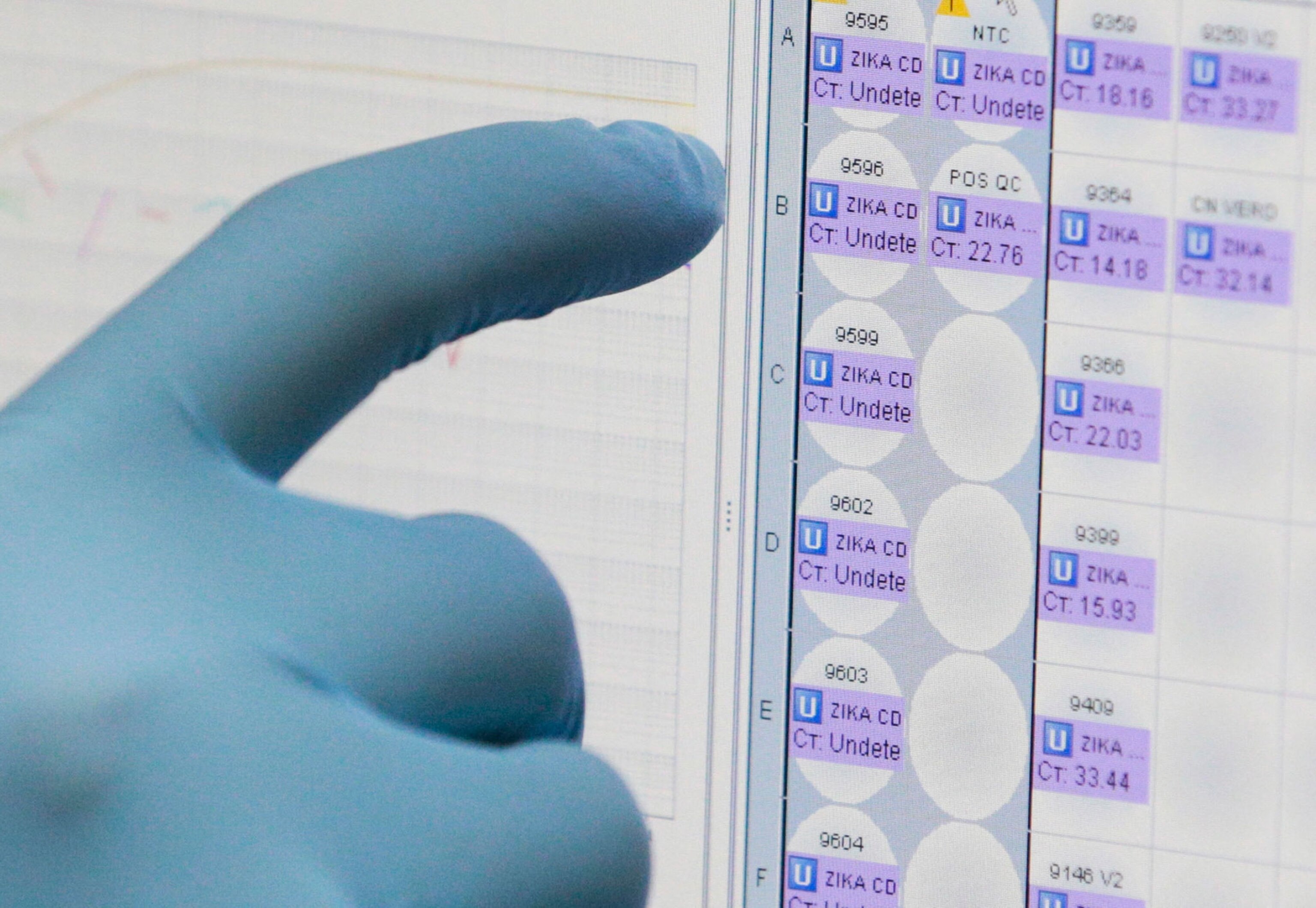 a hand pointing to Zika test results