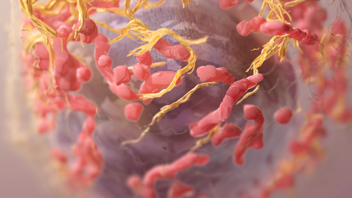 Scientists are figuring out how to make cancer cells self-destruct