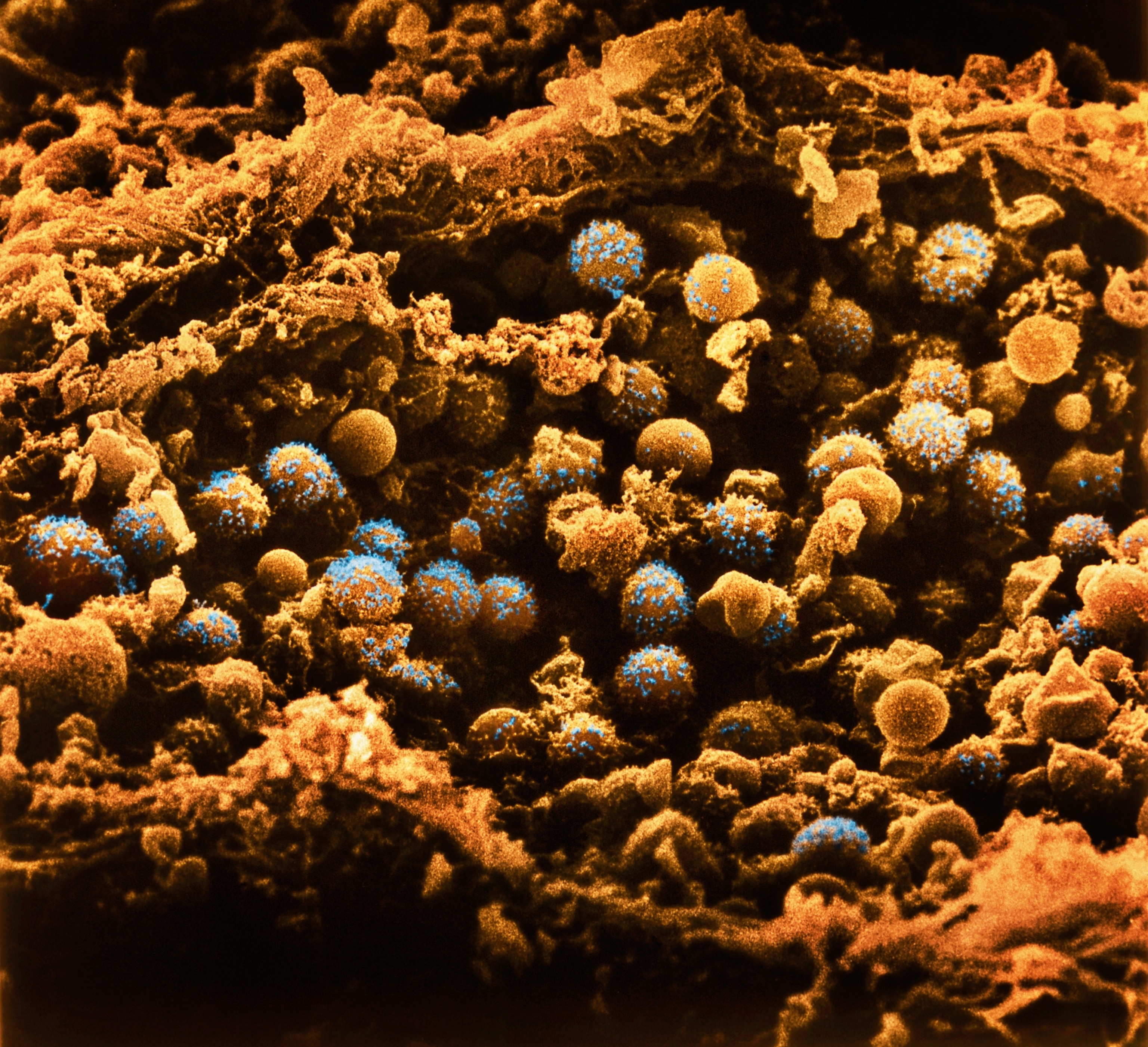 A micrographic view of round secretory cells dotted with blue hormones being released into the bloodstream