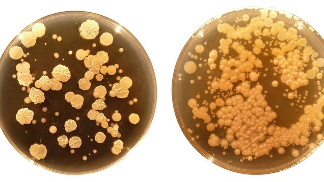 What Lives In Your Belly Button Study Finds Rain Forest Of Species