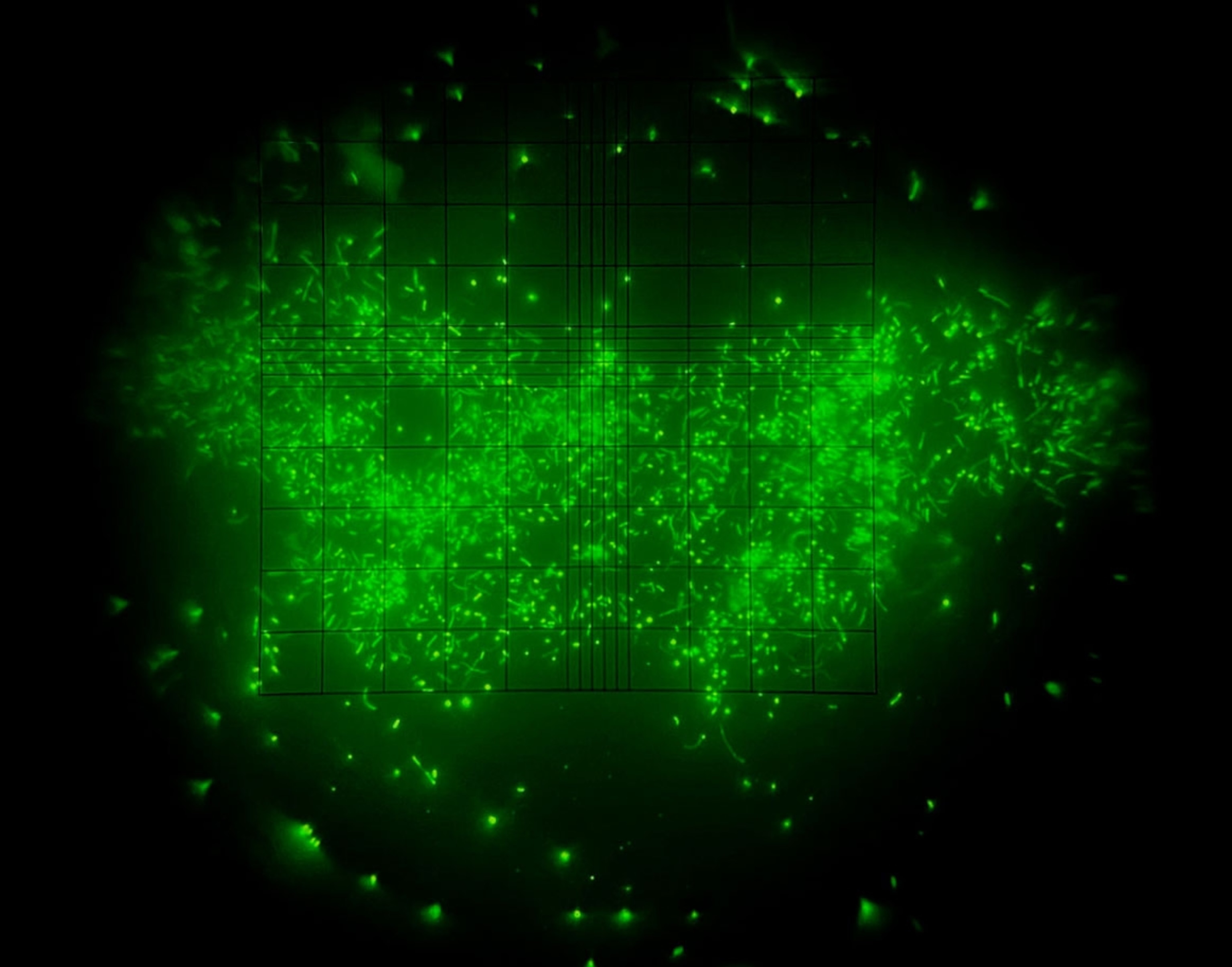 green fluorescence dots on black background.