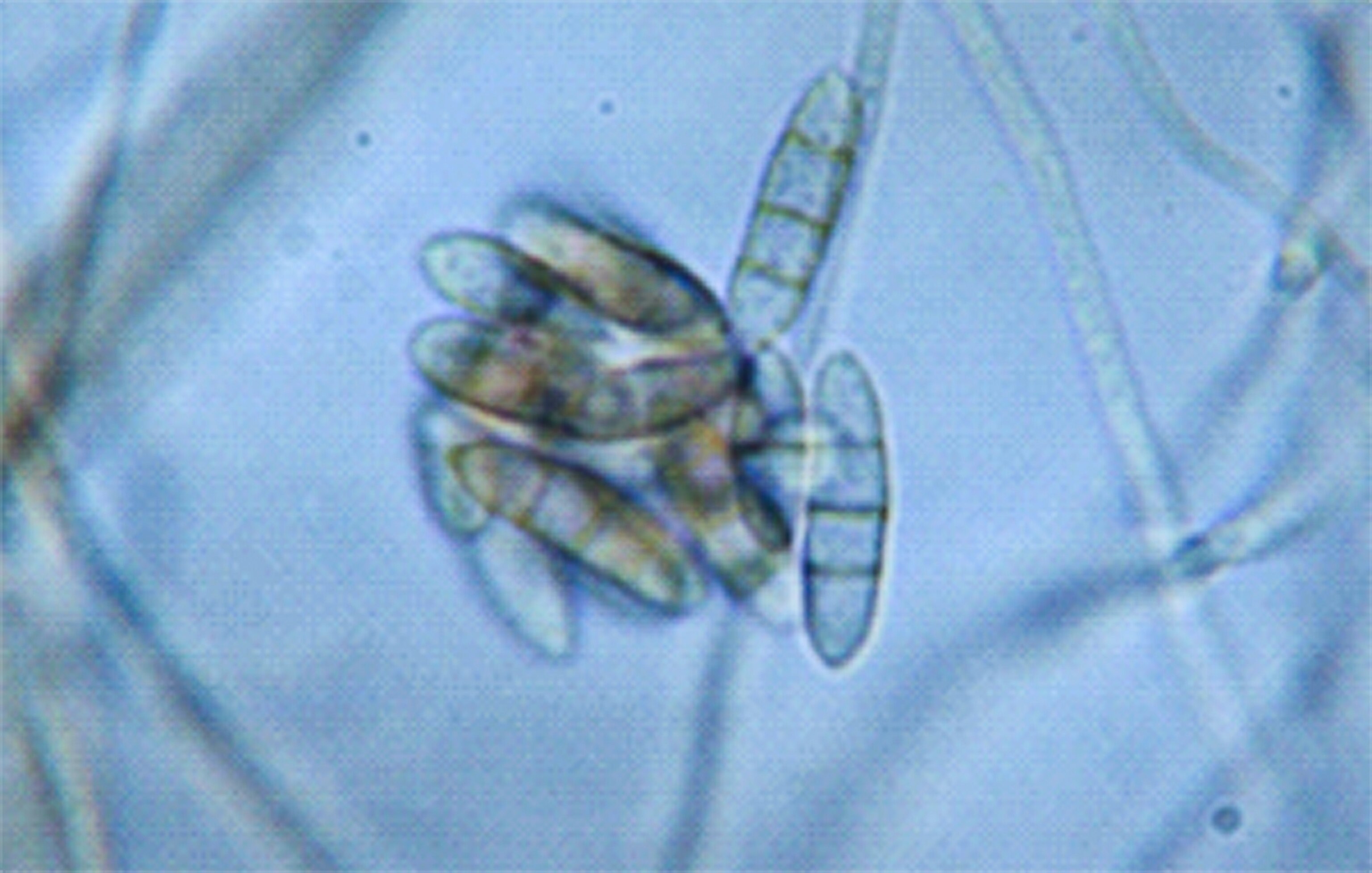 Picture of a black fungus threatening cave paintings in France