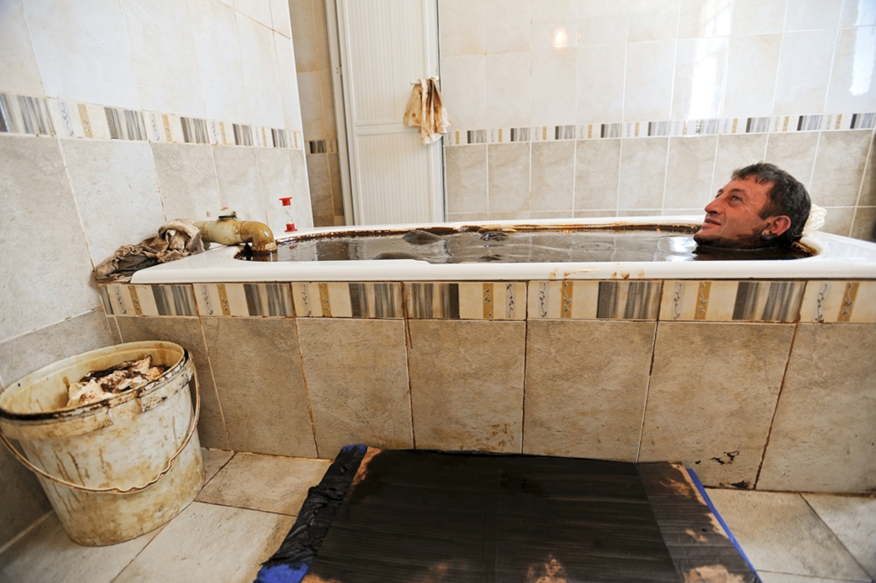 Quliyev Jeyyub takes a crude oil bath at Sehirli Naftalan Health Center and Hotel in Naftalan, Azerbaijan