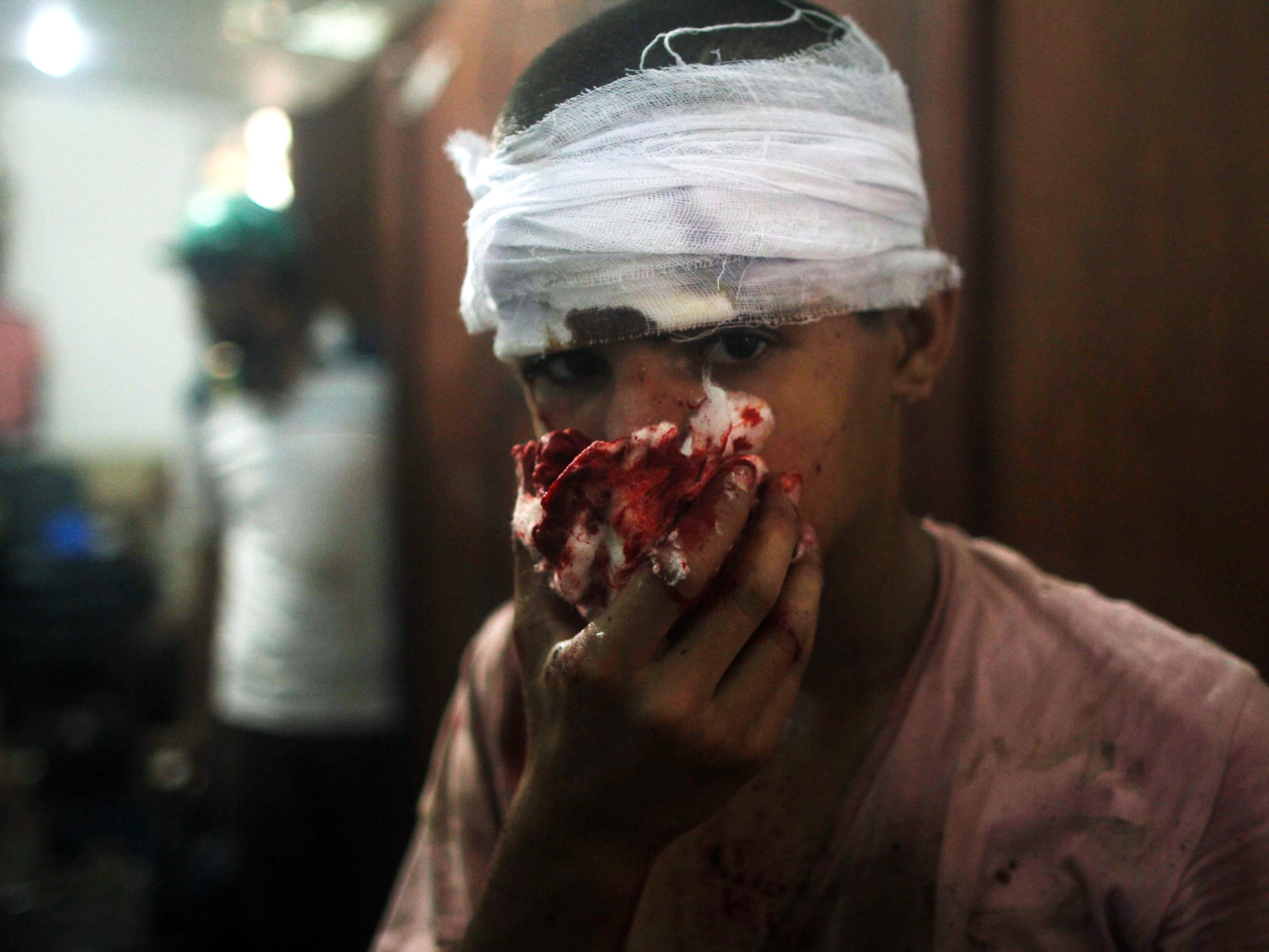 Wounded boy at a makeshift hospital.