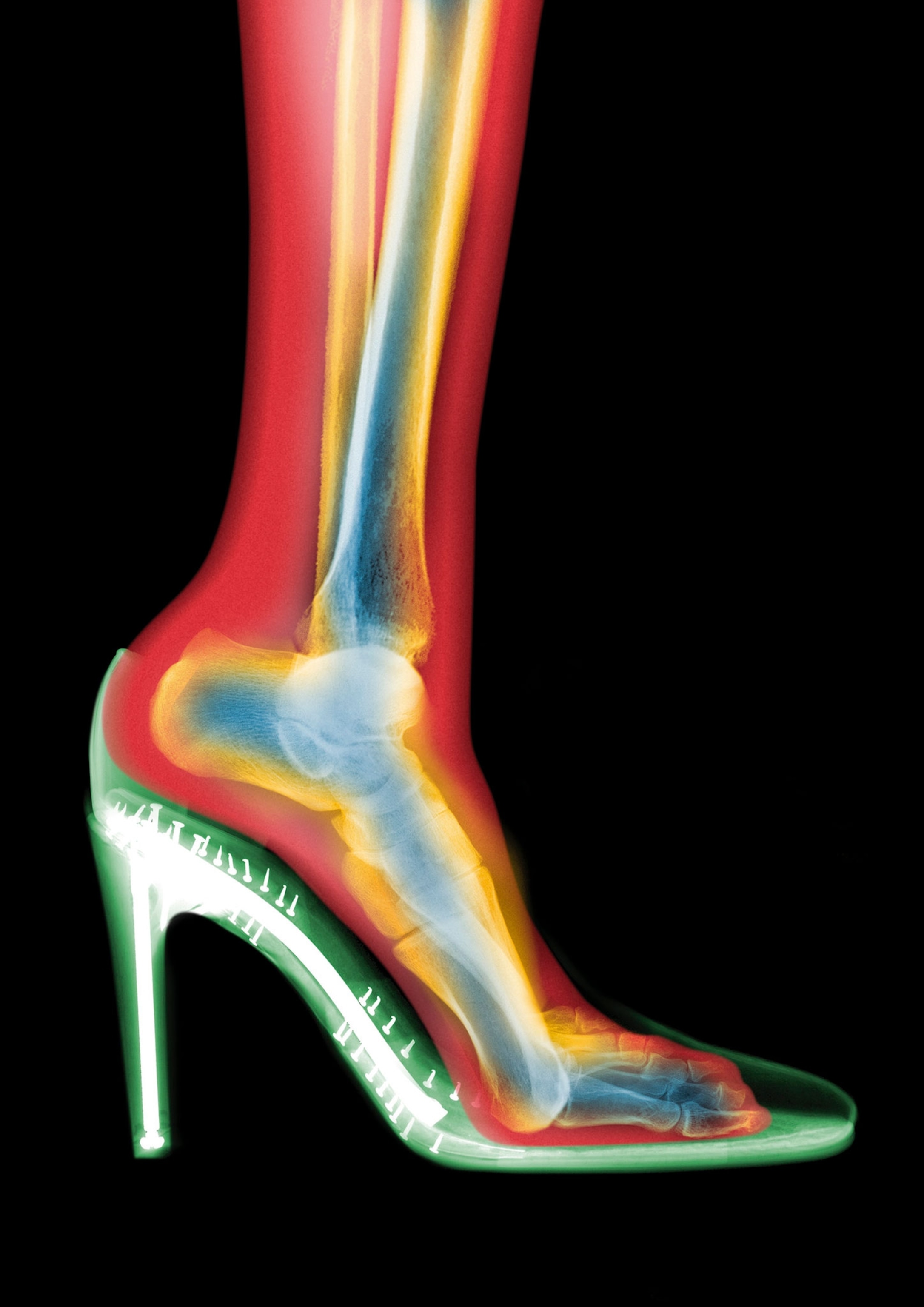The outline of a leg, bone, and shoe can with a colorful hue on a black background.