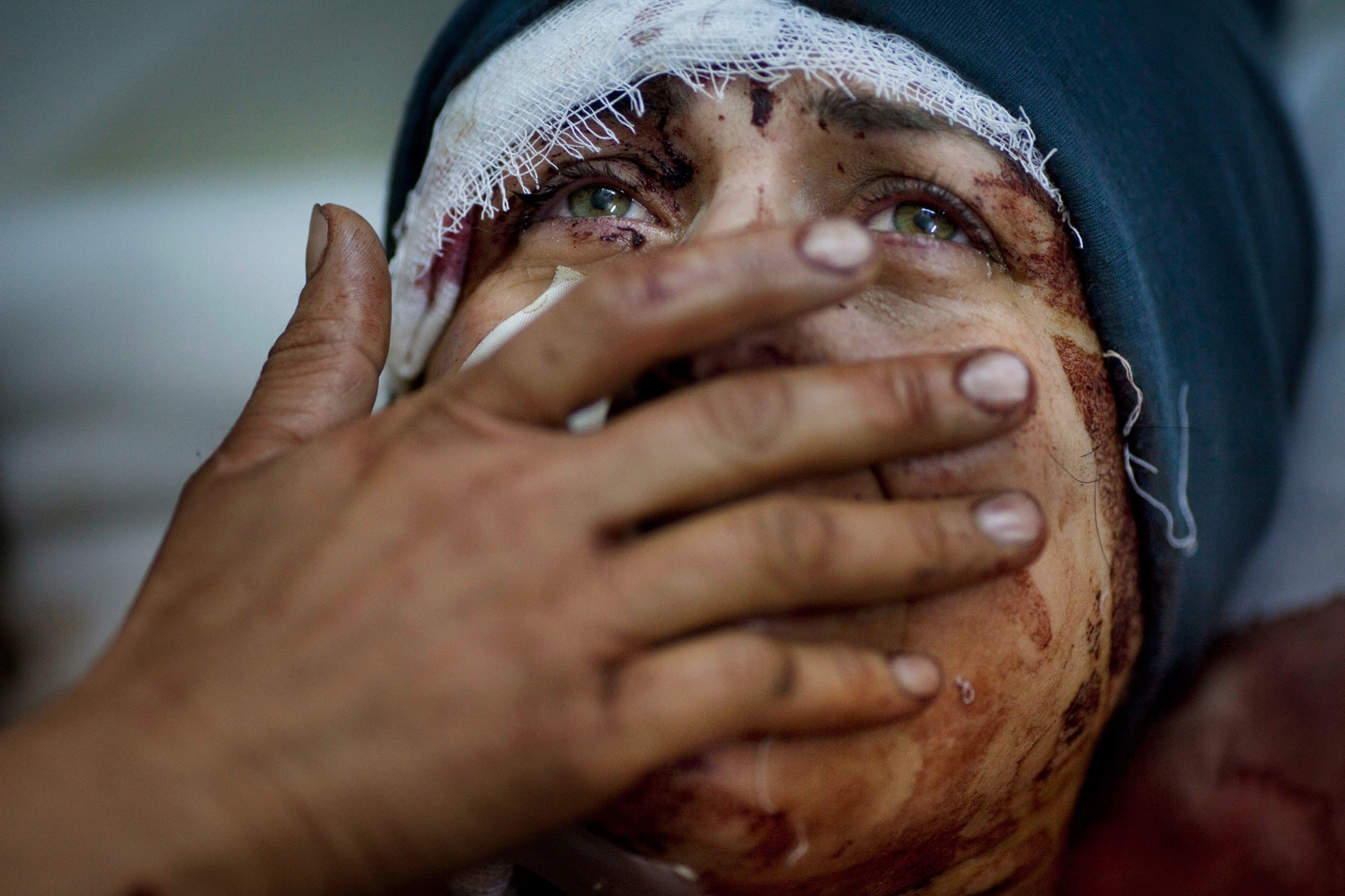 a Syrian woman covering her bloodied face with her hand as tears run down her face