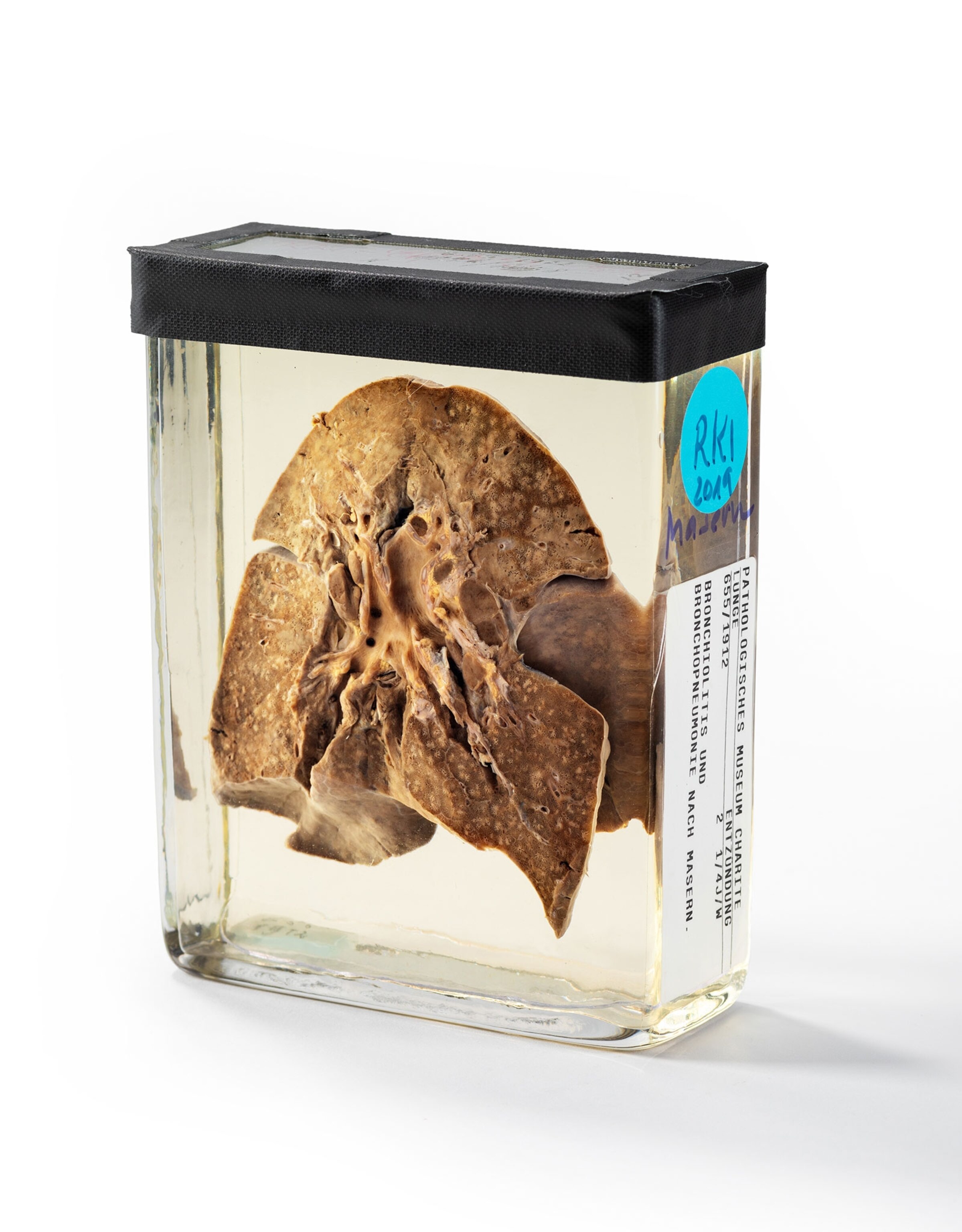 human lungs preserved in clear glass container.