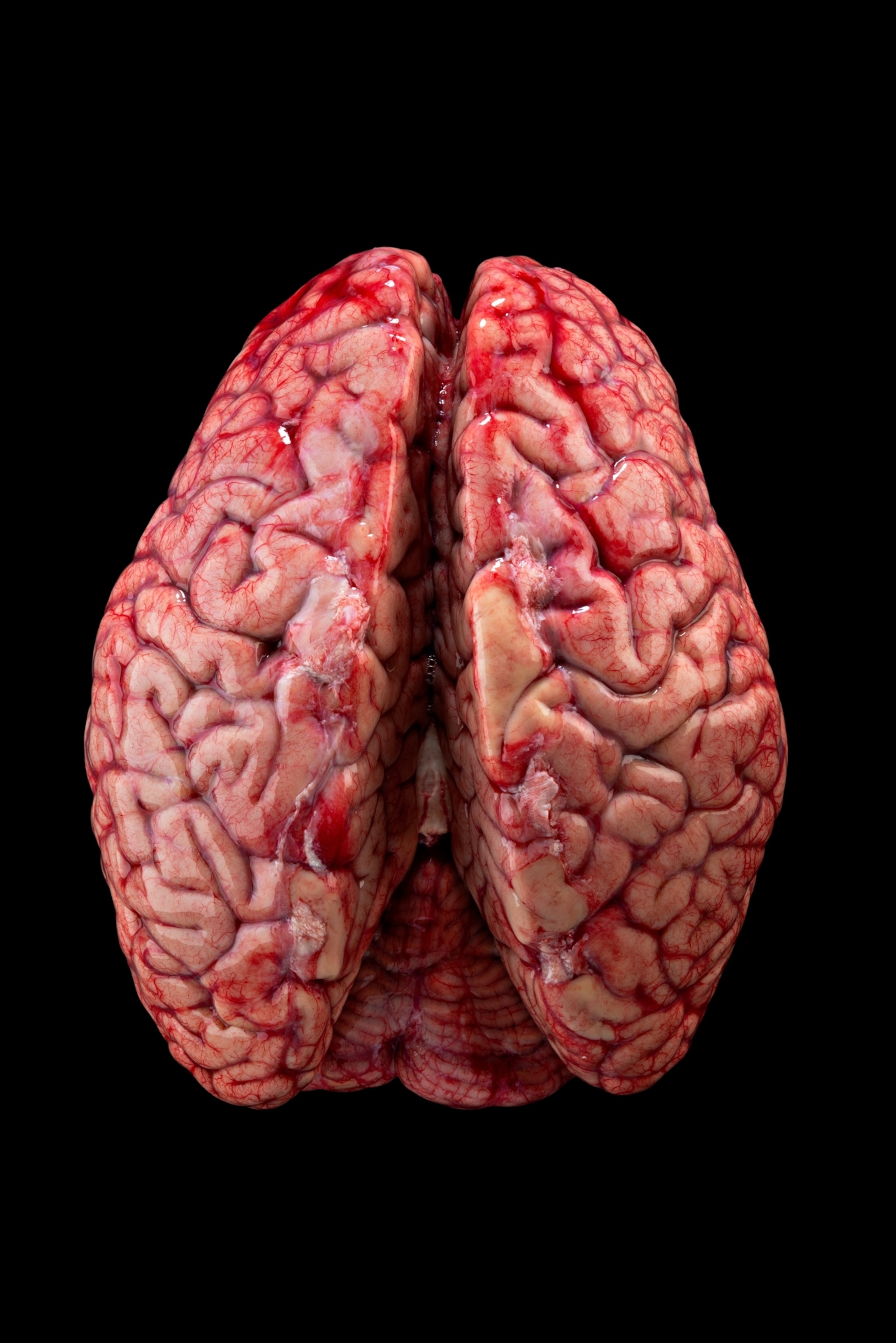 human brain on black background.