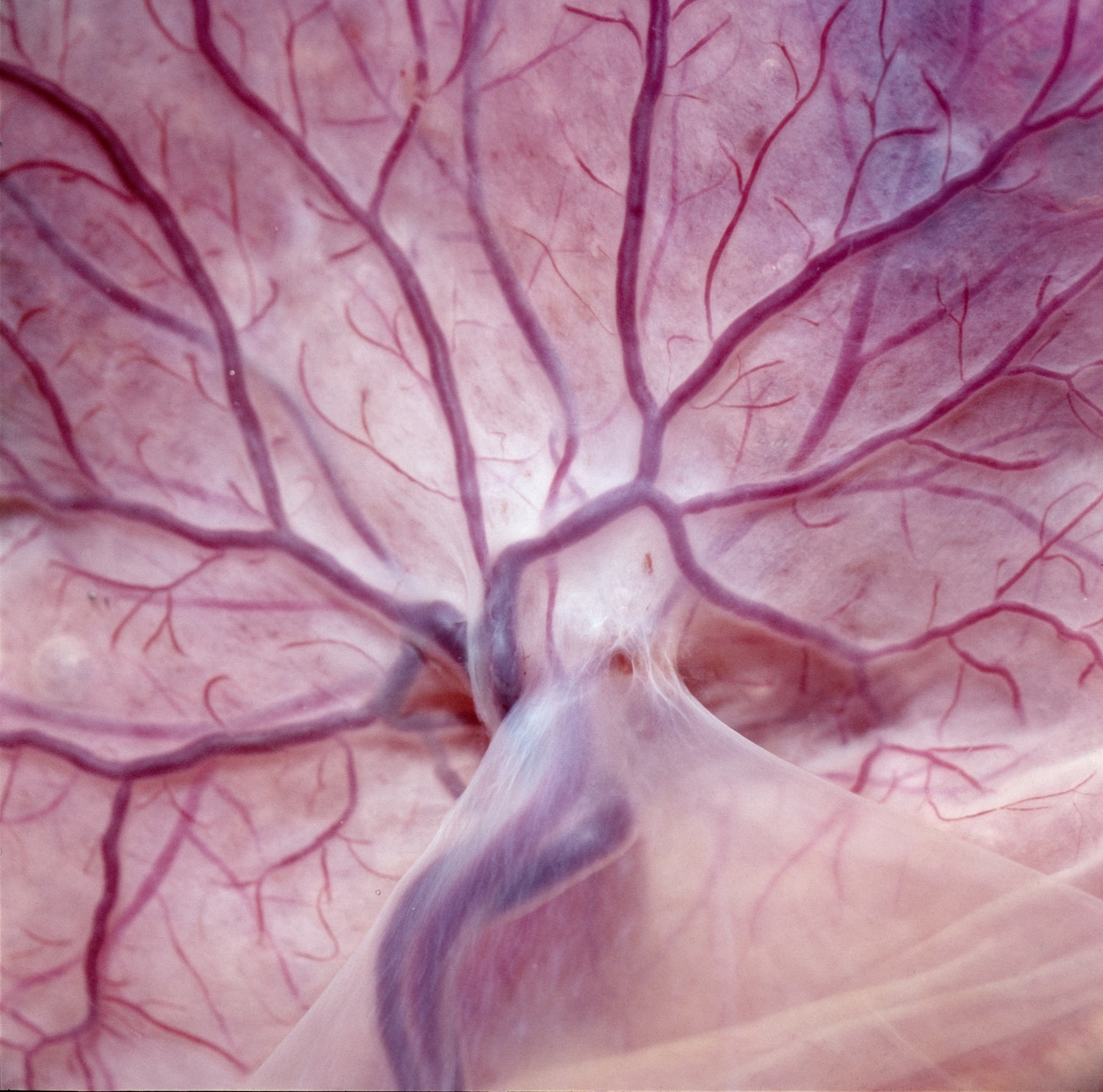 A close-up view of the human placenta showing a complex network of dark purple blood vessels branching out across the pale, translucent tissue.