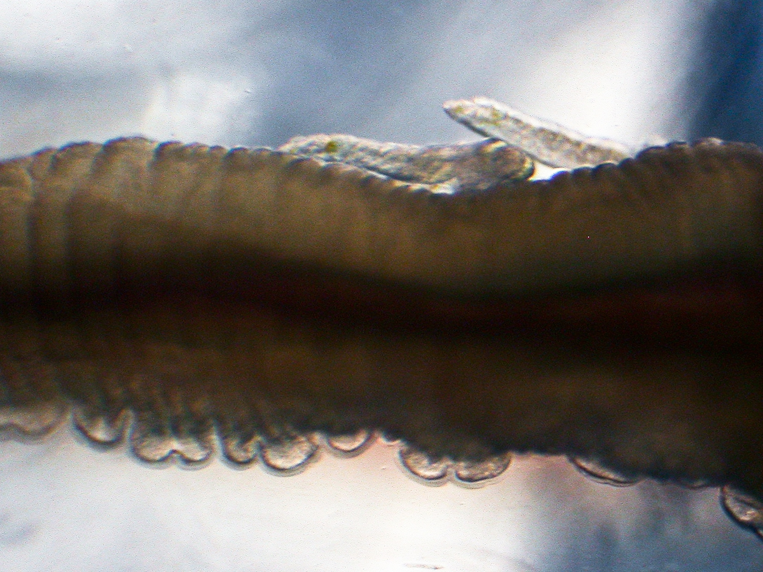 New Boneworm - Picture of male bone-eating worms discovered in Antarctica