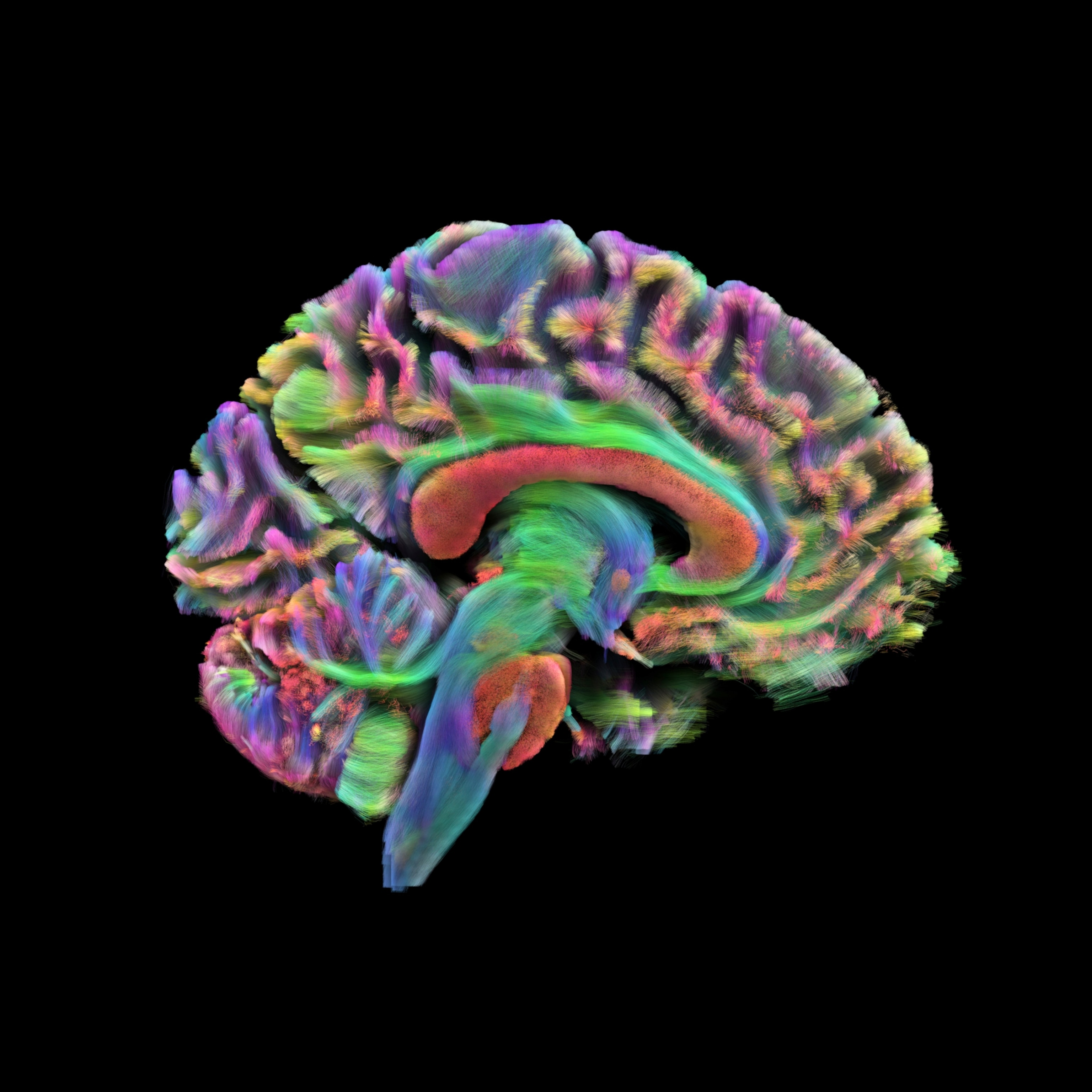 A colorized diffusion tensor imaging scan showing the major white matter nerve fibers in a human brain