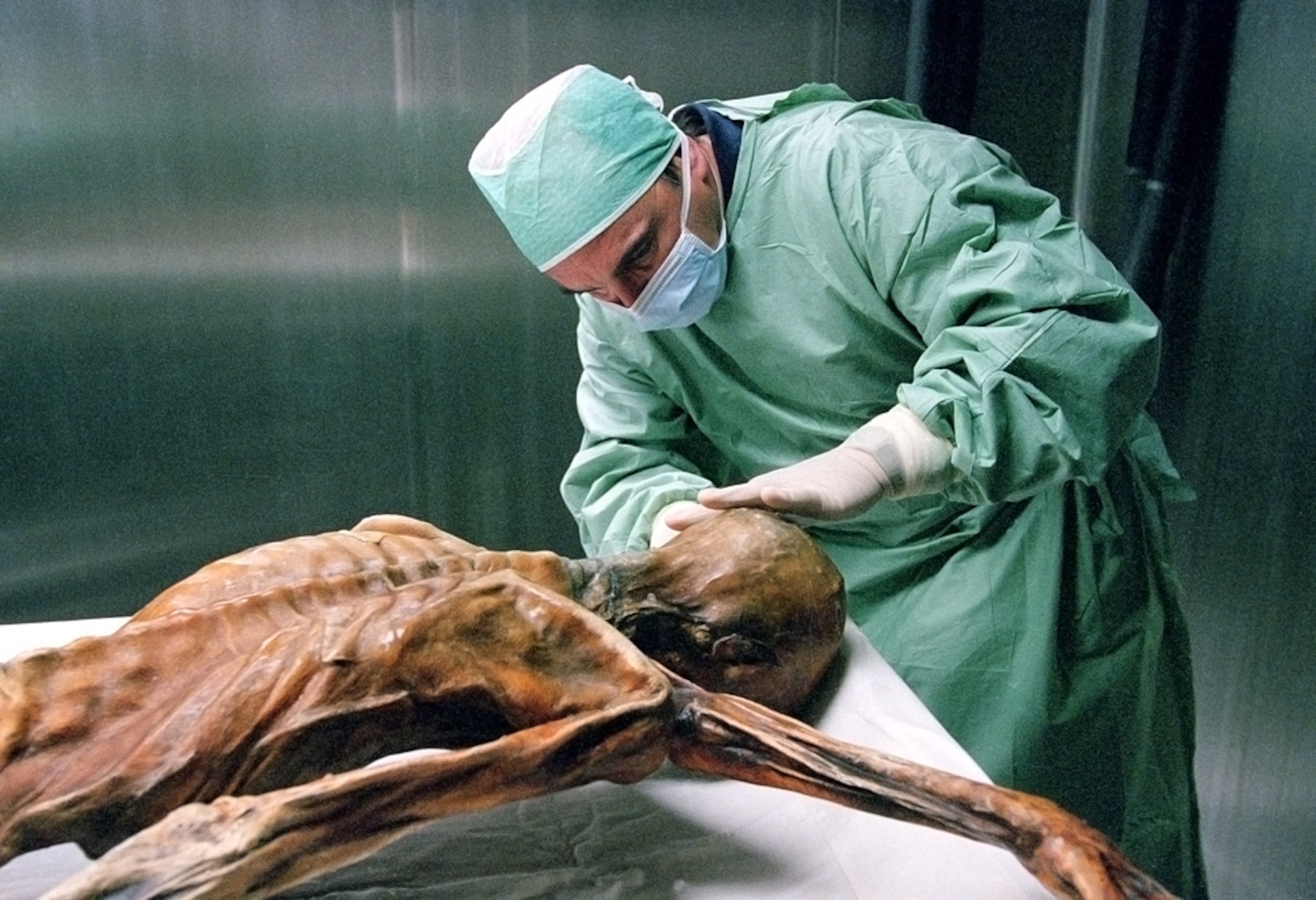 Ötzi the Iceman picture: Examining the mummy
