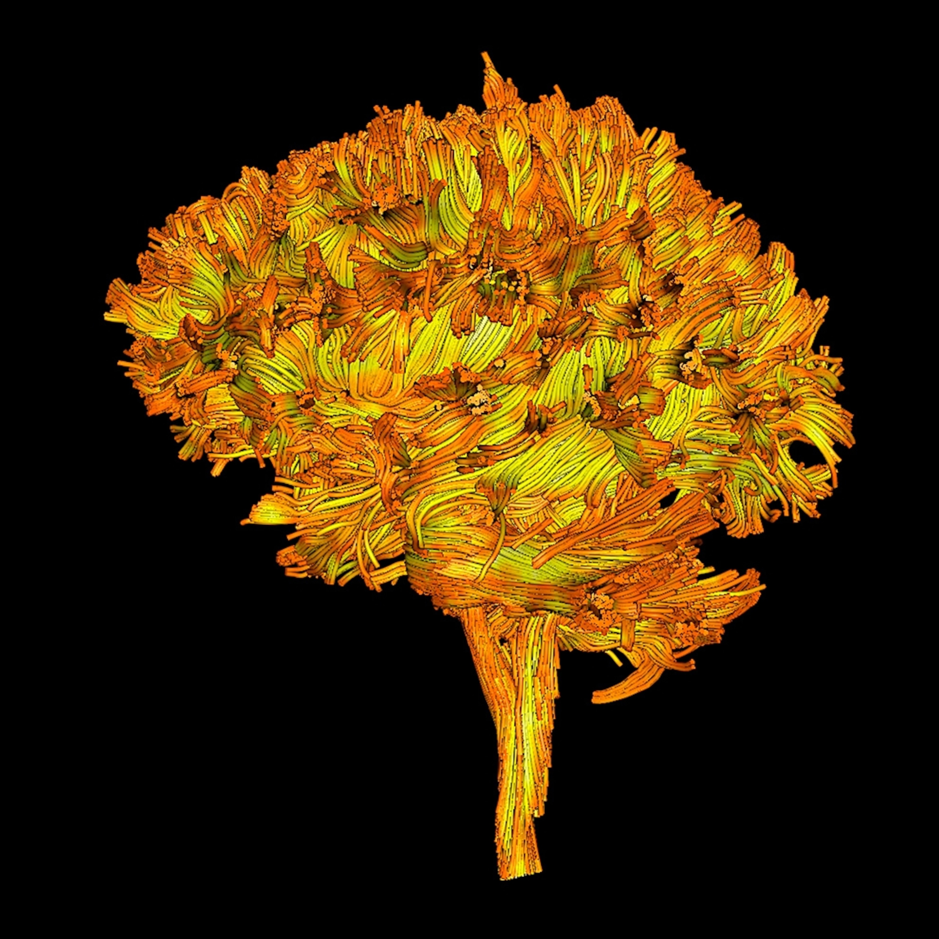 Brain picture: A diffusion tensor image shows nerve fibers in the brain.