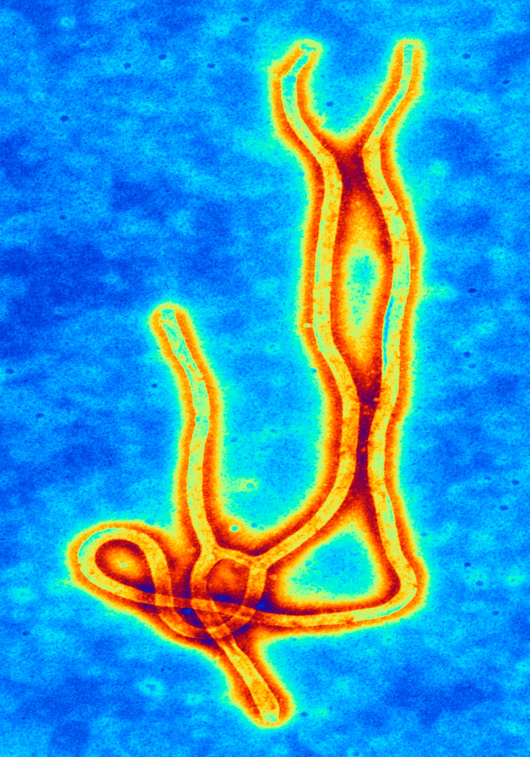 Microscopic view of the Ebola virus, showing long, intertwined, tubular structures in vibrant orange against a blue background