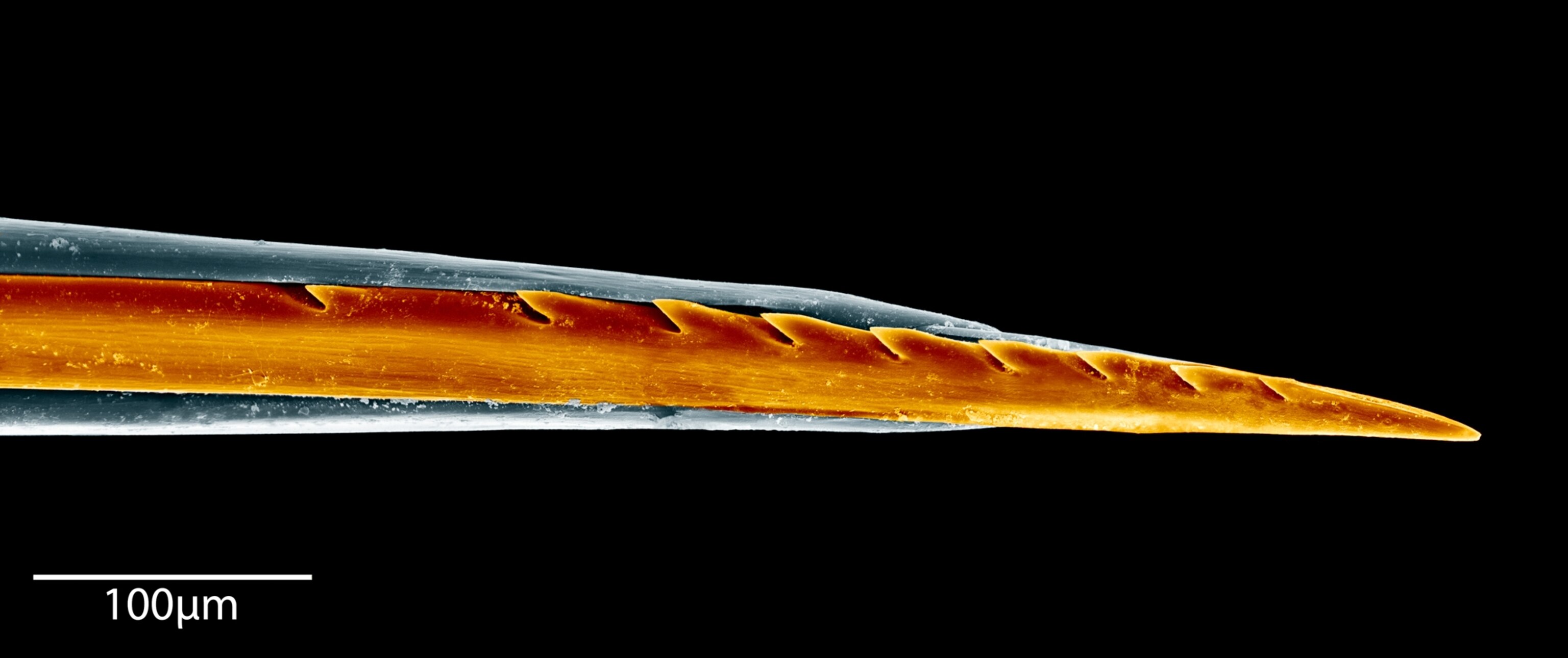 A microscopic view of a wasp stinger showing barb-like hooks along its surface