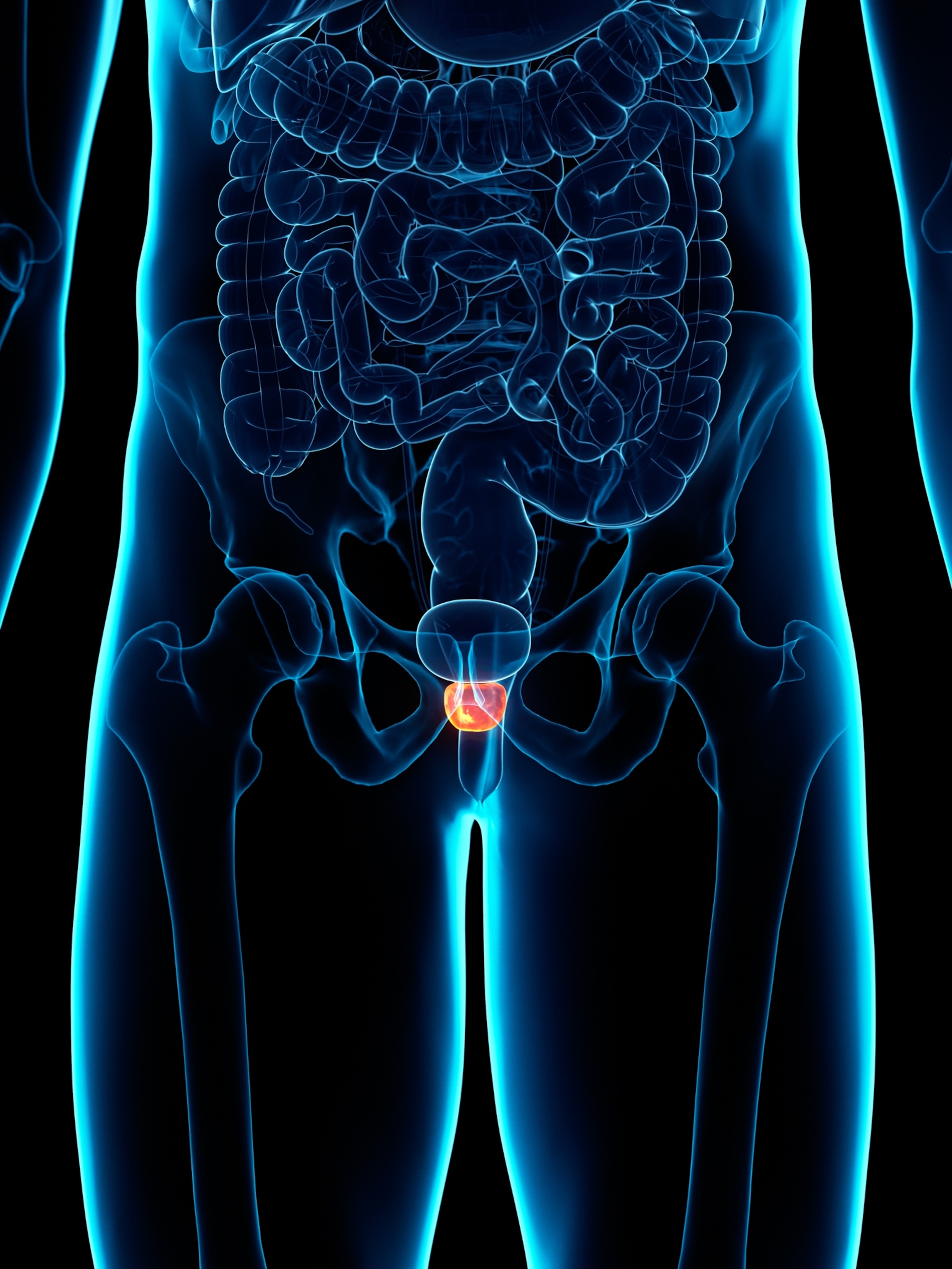 X-ray style image of the lower male torso highlighting the prostate gland in red against a blue outline of the bones and intestines on a black background.