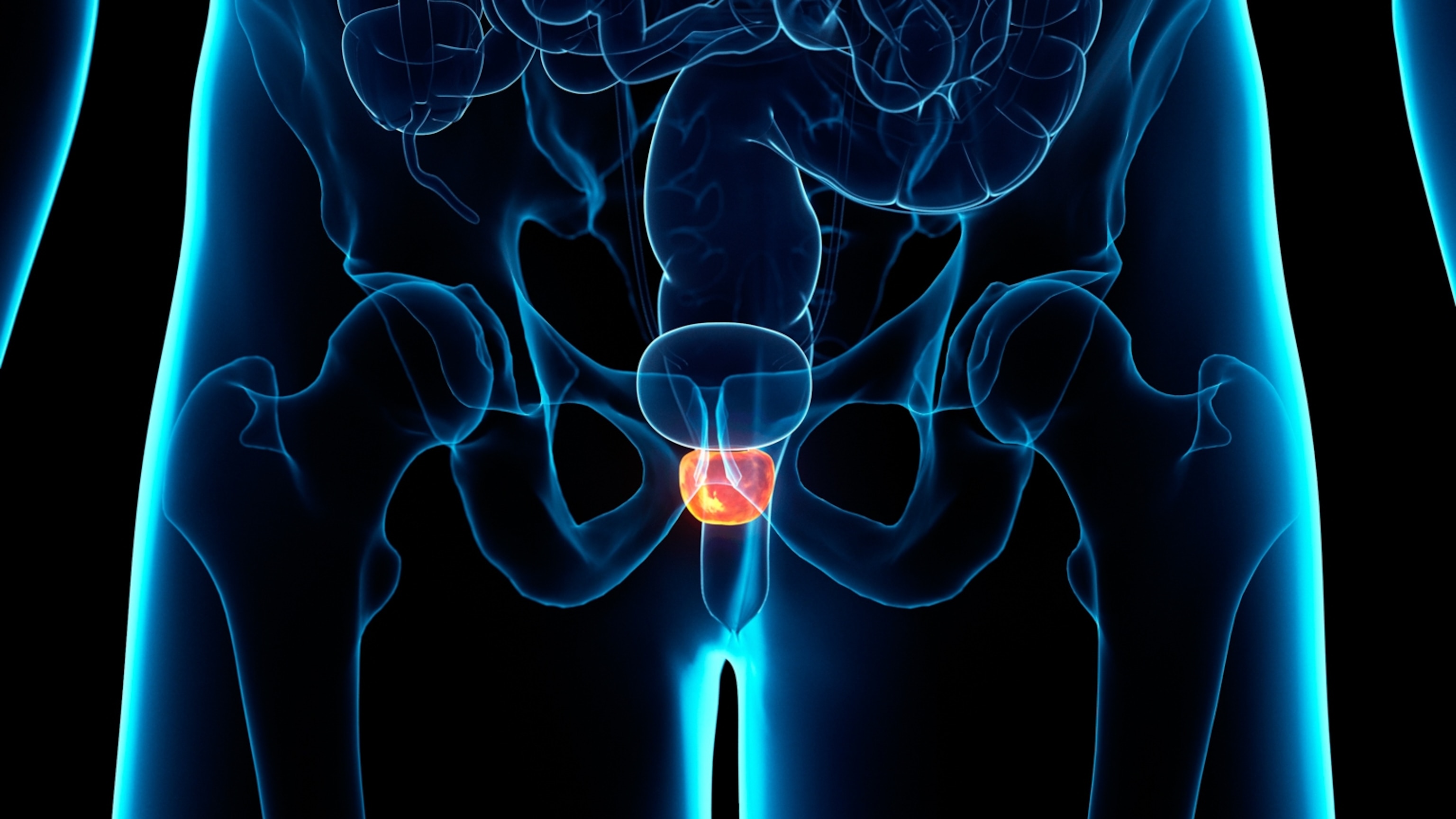 How breast cancer research is helping prostate cancer patients