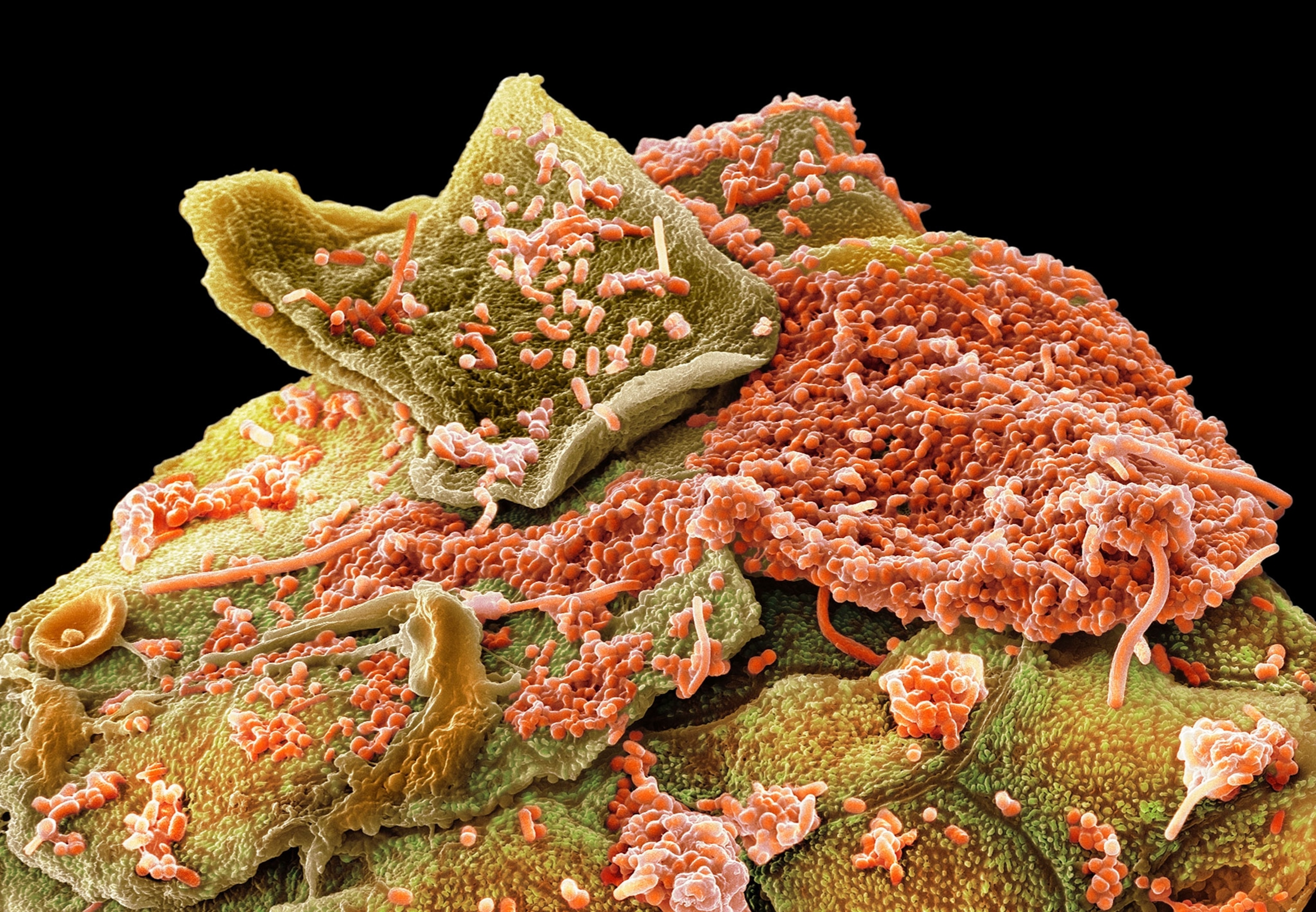 Oral bacteria. Colored scanning electron micrograph (SEM) of mixed oral bacteria attached to buccal cells (brown) from the cheek.