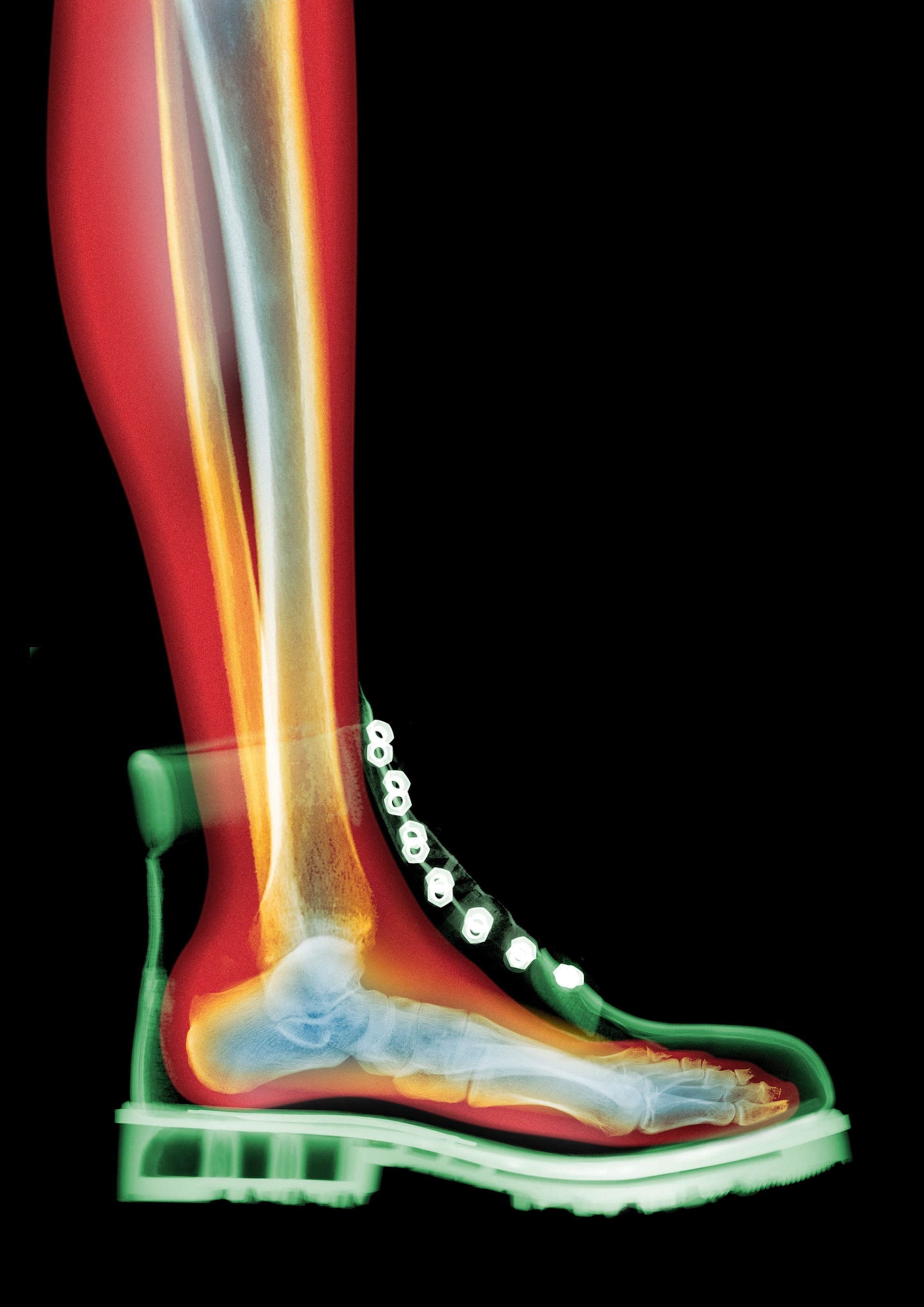 The calf, bones, ant boot on a person is outlined in various colors.