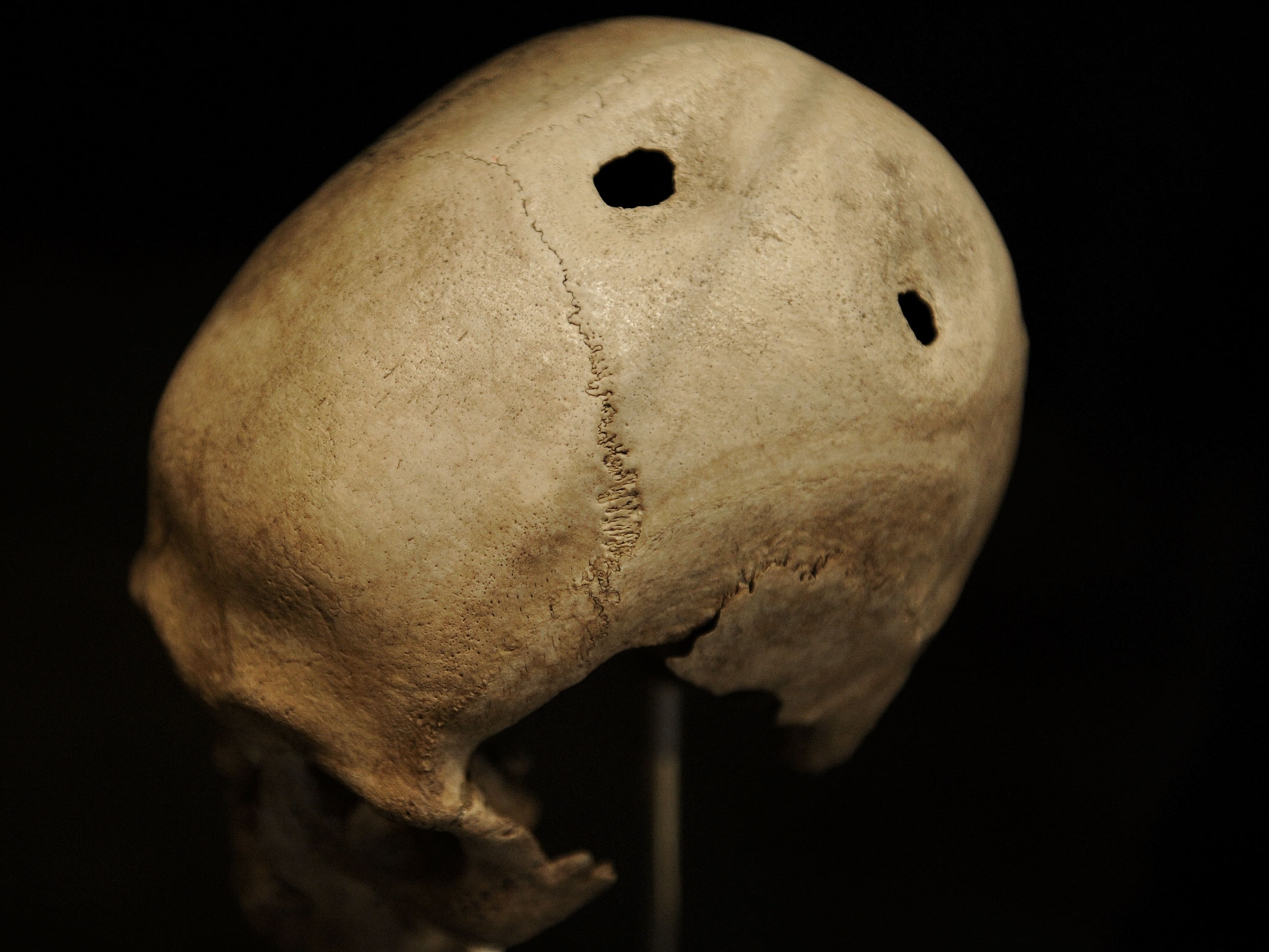 Amazing Things We’ve Learned From 800 Ancient Skull Surgeries