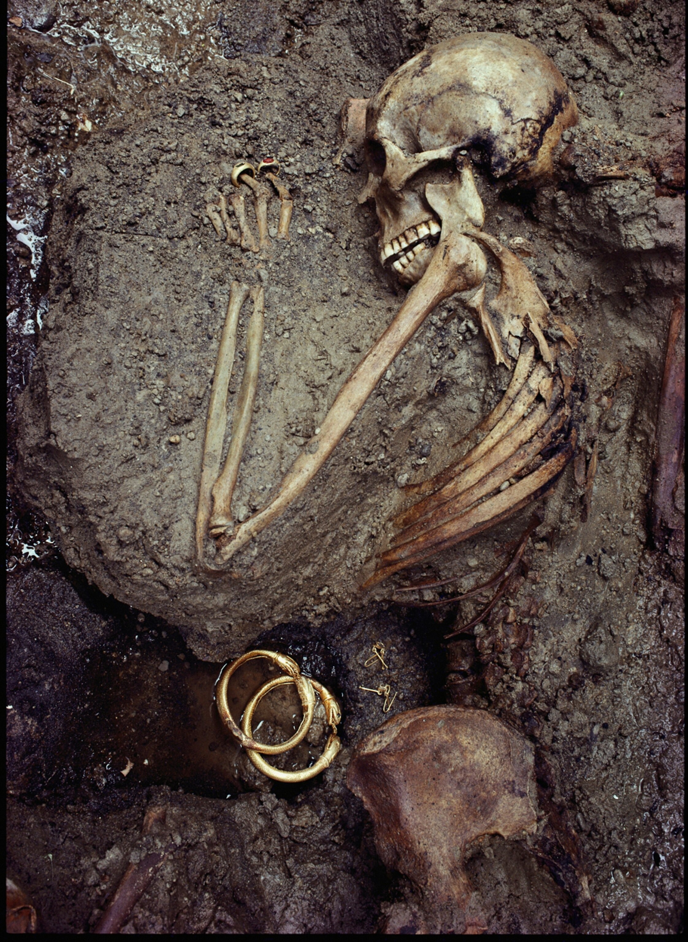 The skeleton of a 45-year-old woman buried with a treasure of jewels from Herculaneum, lesser known sister city of Pompeii. Both cities were destroyed by the A.D. 79 eruption of Vesuvius.