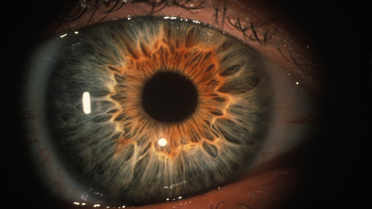 Why did humans evolve to blink?