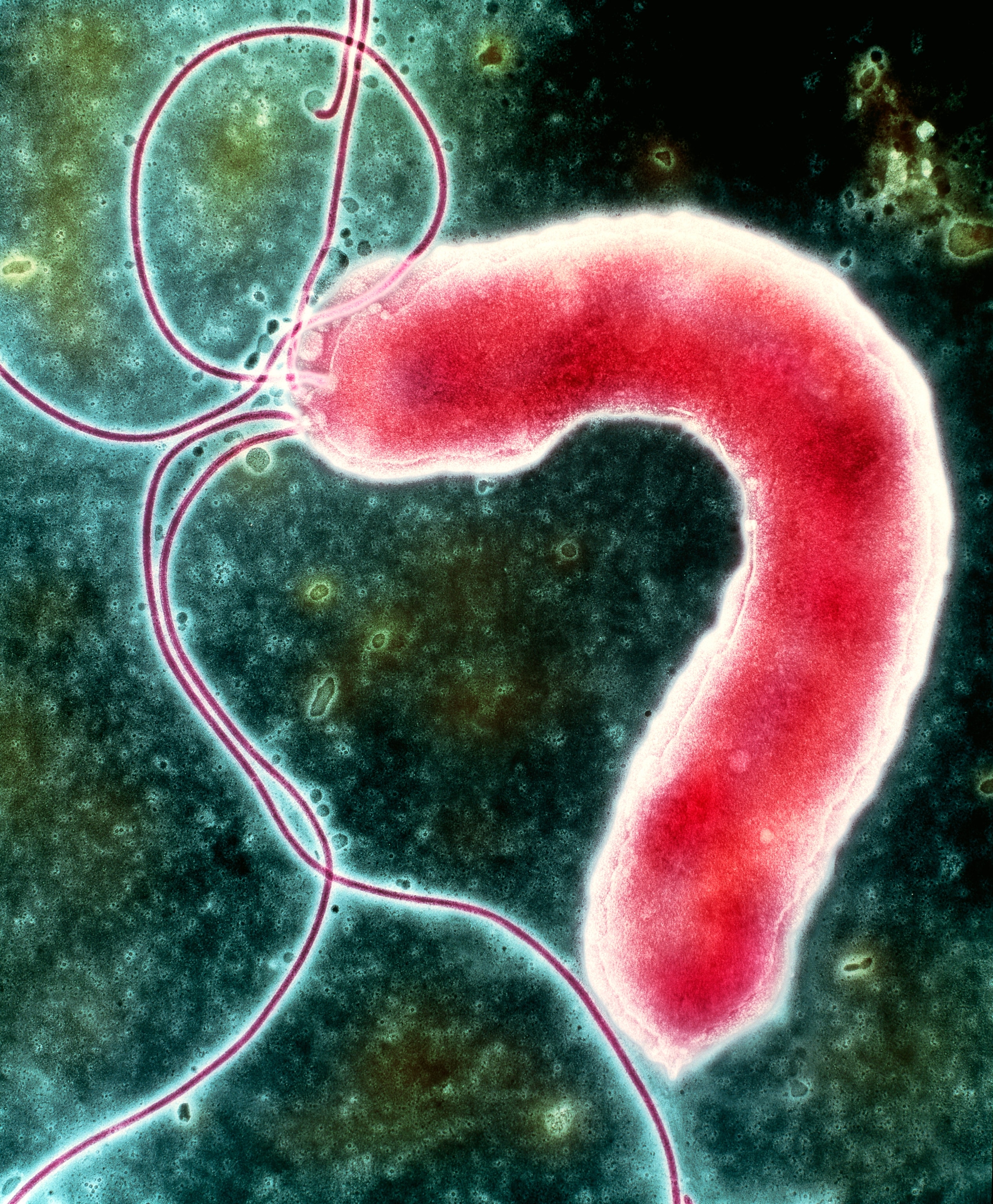 Colorized electron micrograph showing a single, curved Helicobacter pylori bacterium in red with long, thin flagella against a green background.