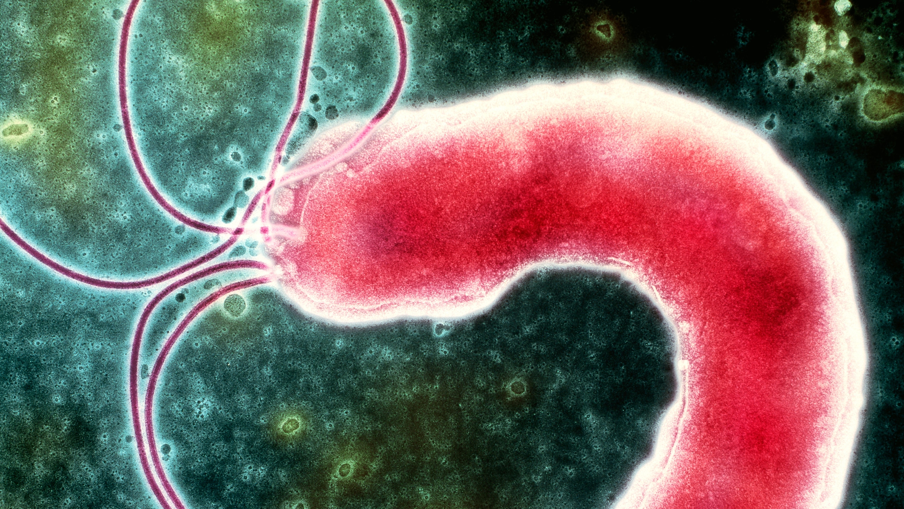 How the bacteria in your gut could raise colon cancer risk