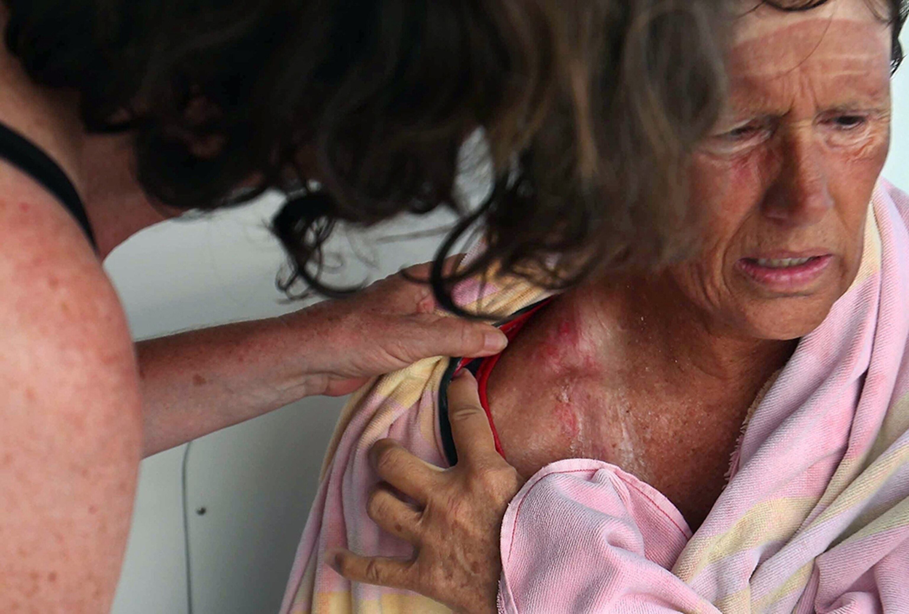 swimmer Diana Nyad being treated for injuries