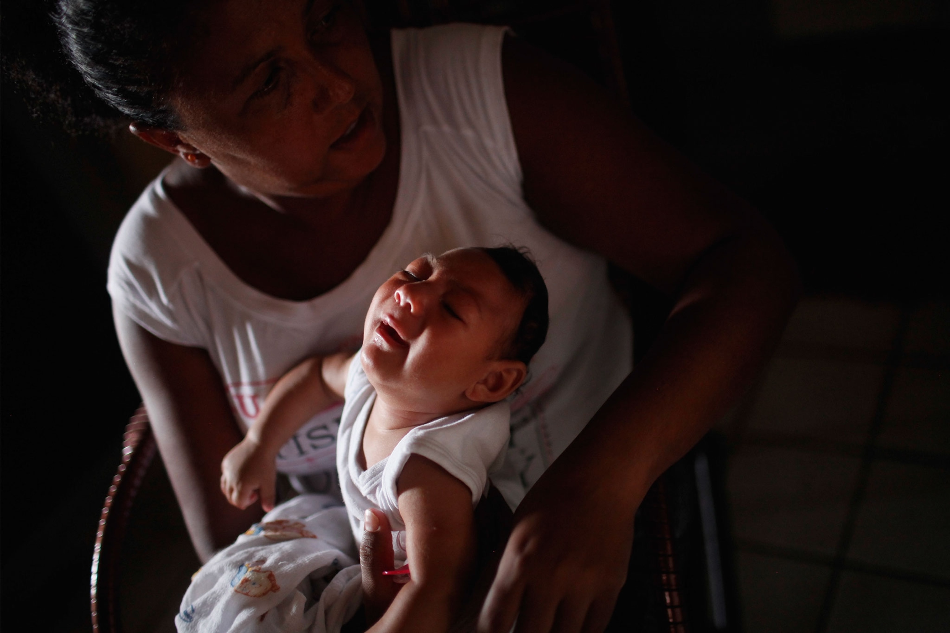 a baby with microcephaly