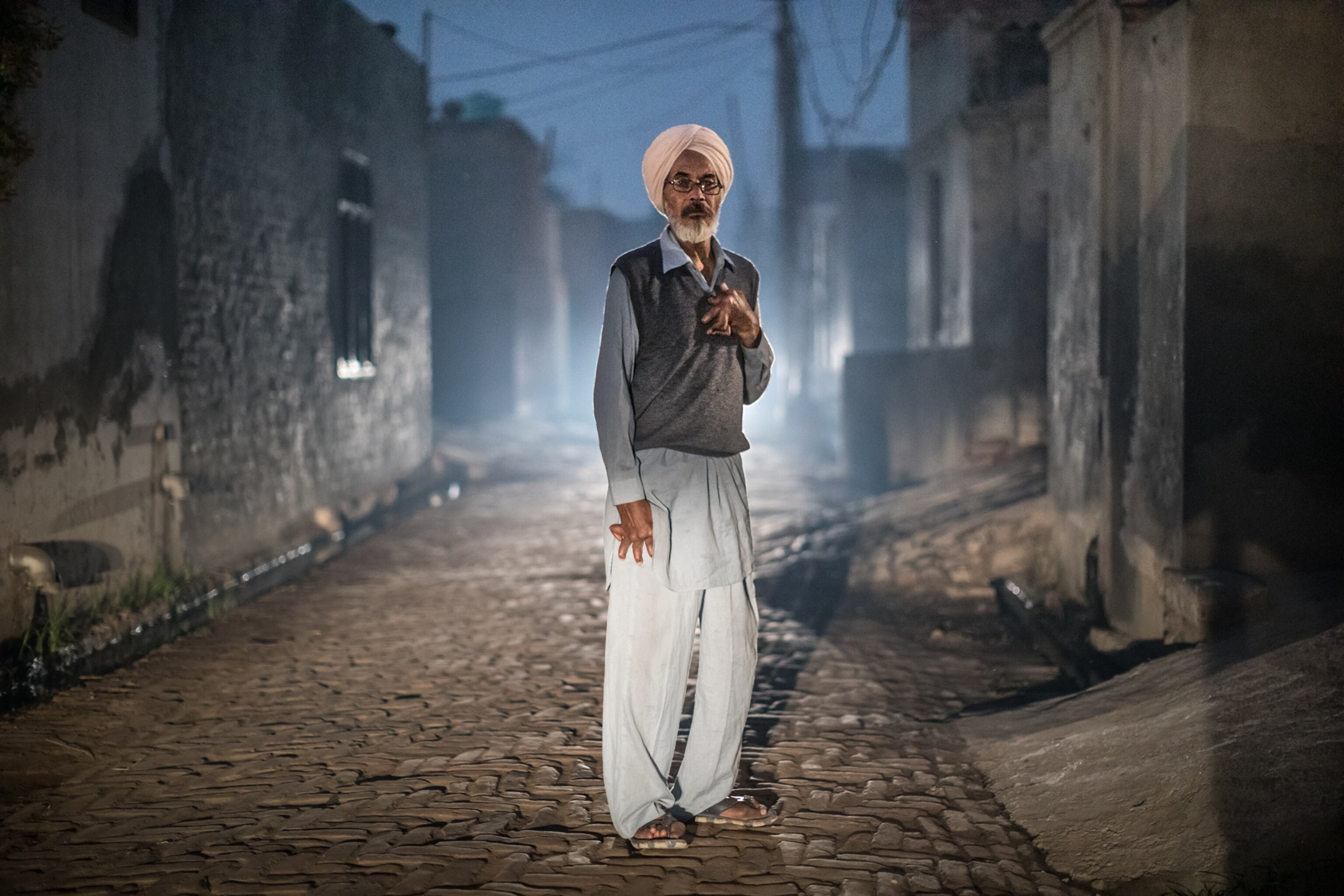 man with deformed hands.