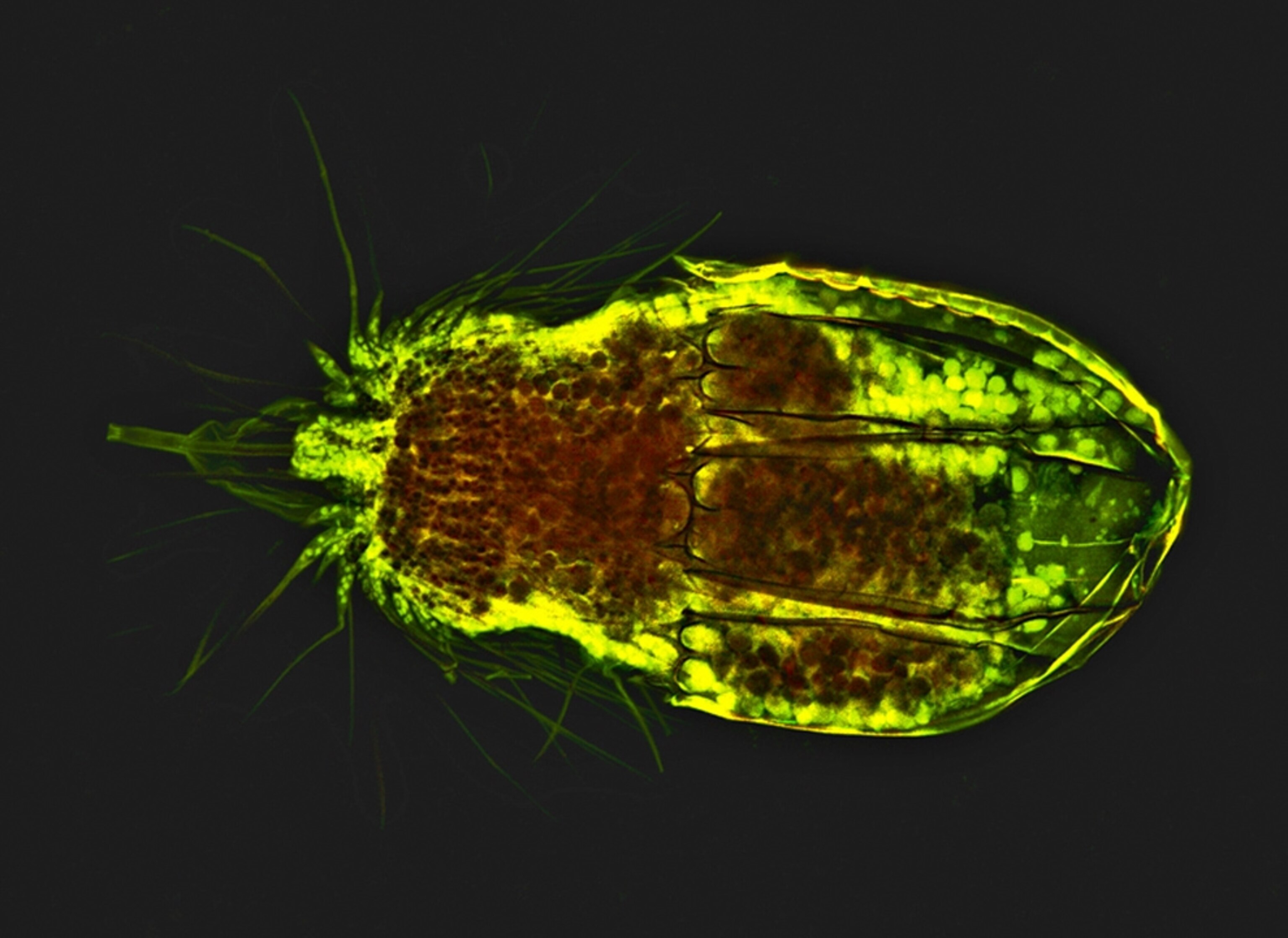 a locifera microbe with a yellow glow, inventoried as part the Census of Marine Life's study of hard-to-see sea creatures